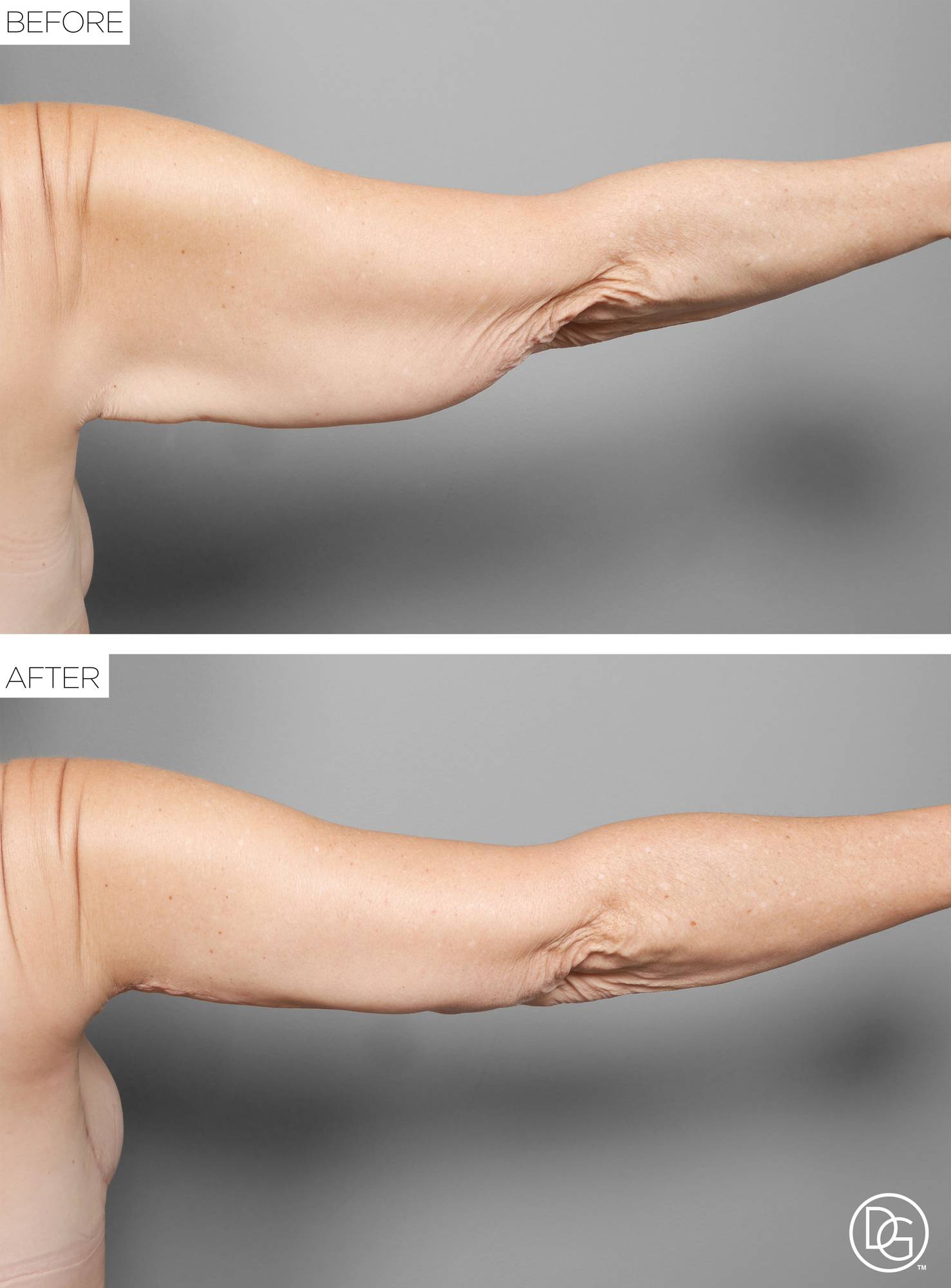 Before & After Image