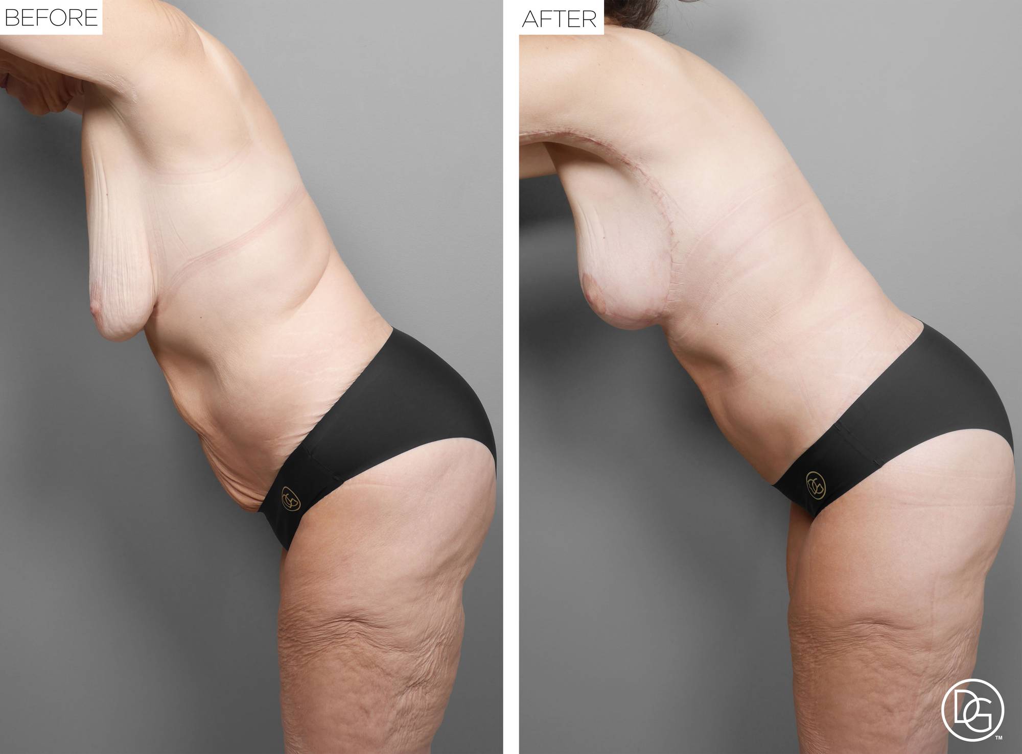 Before & After Image