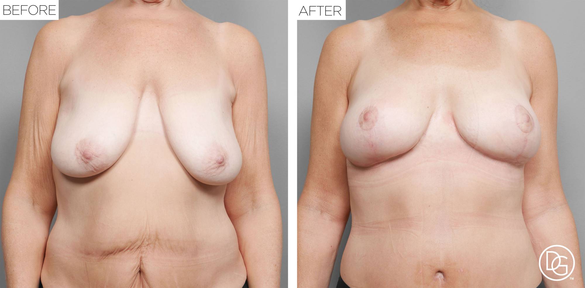 Before & After Image