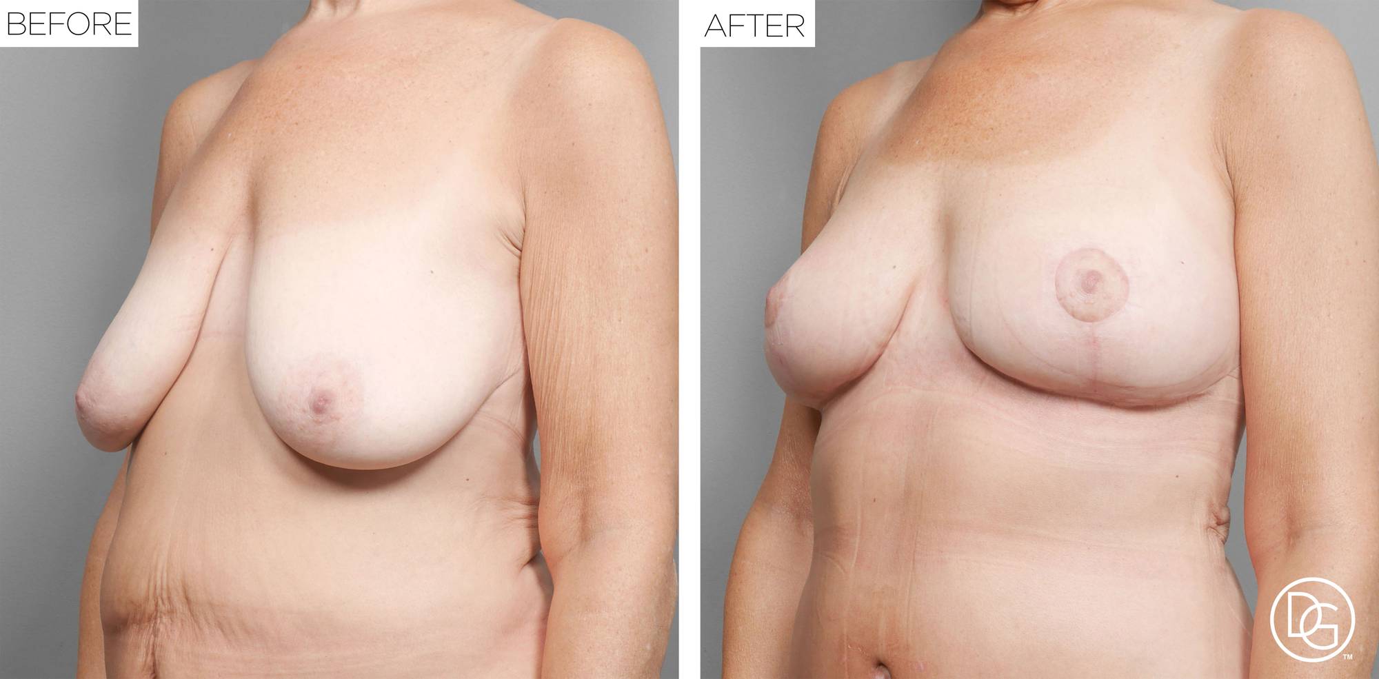 Before & After Image