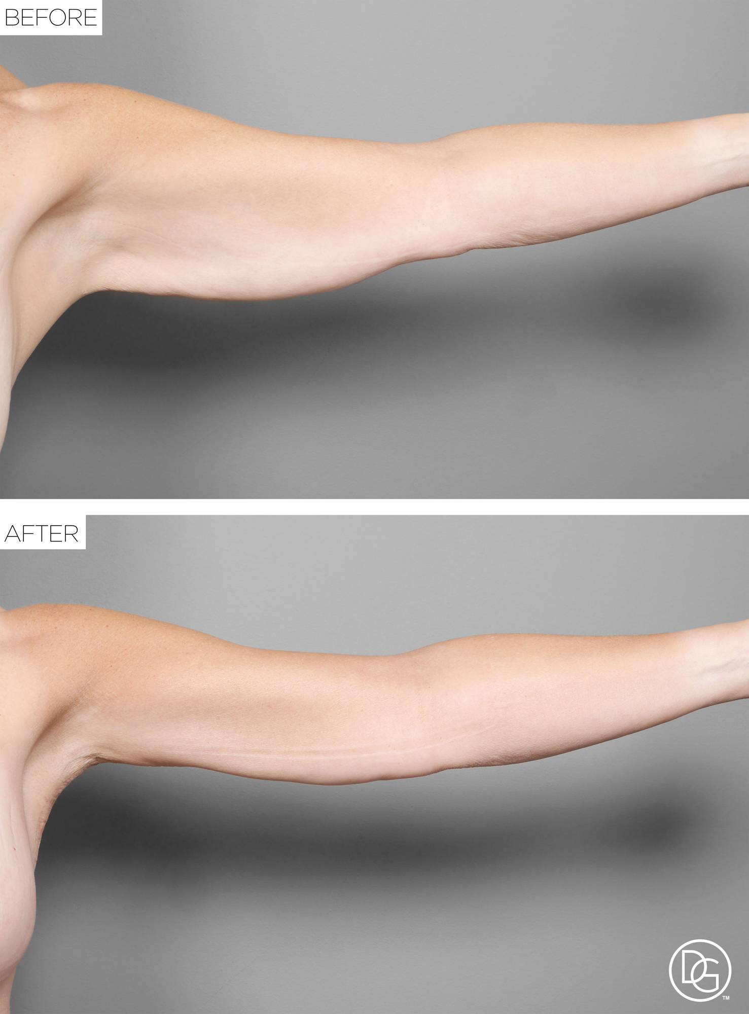 Before & After Image