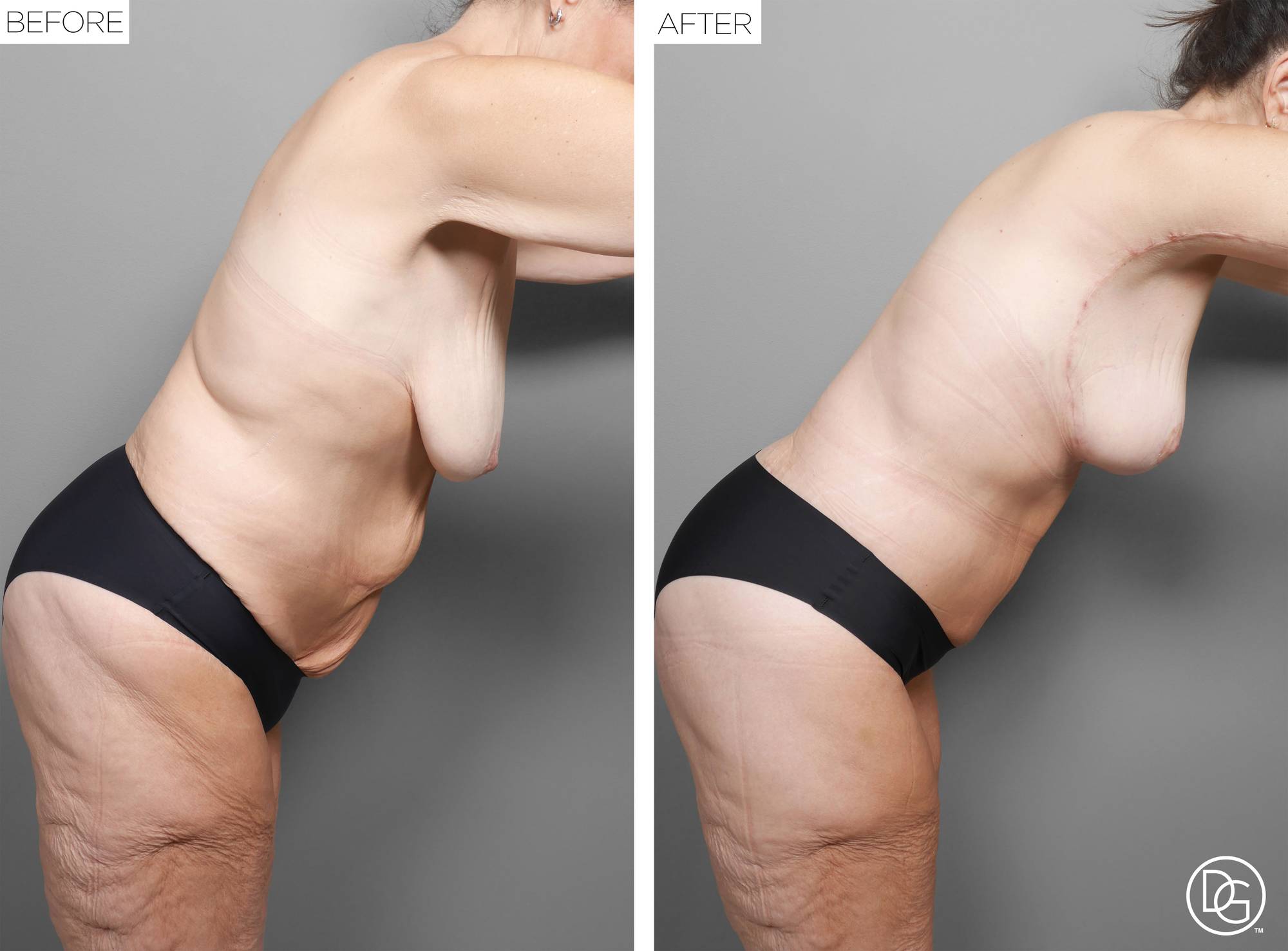 Before & After Image