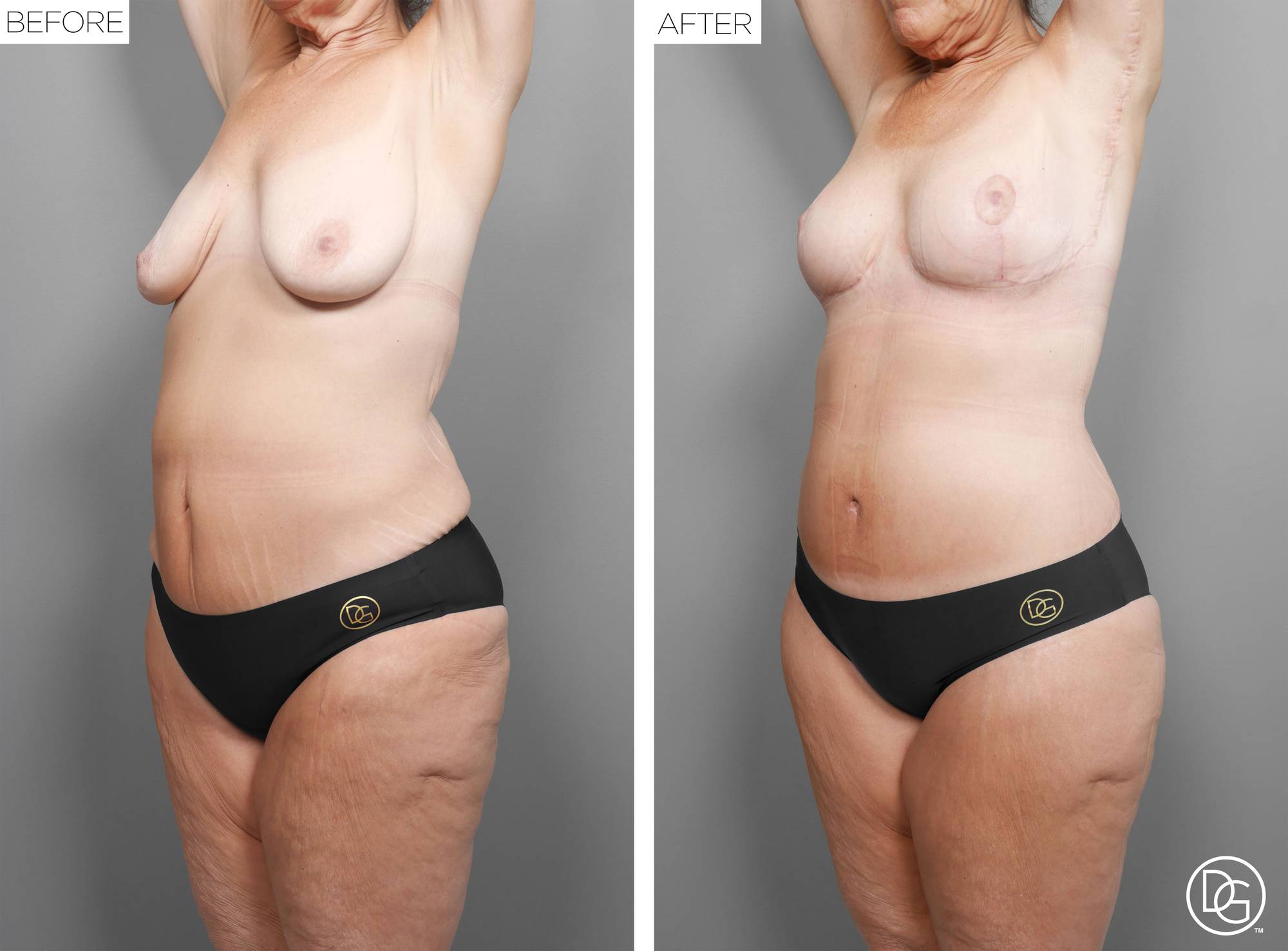 Before & After Image