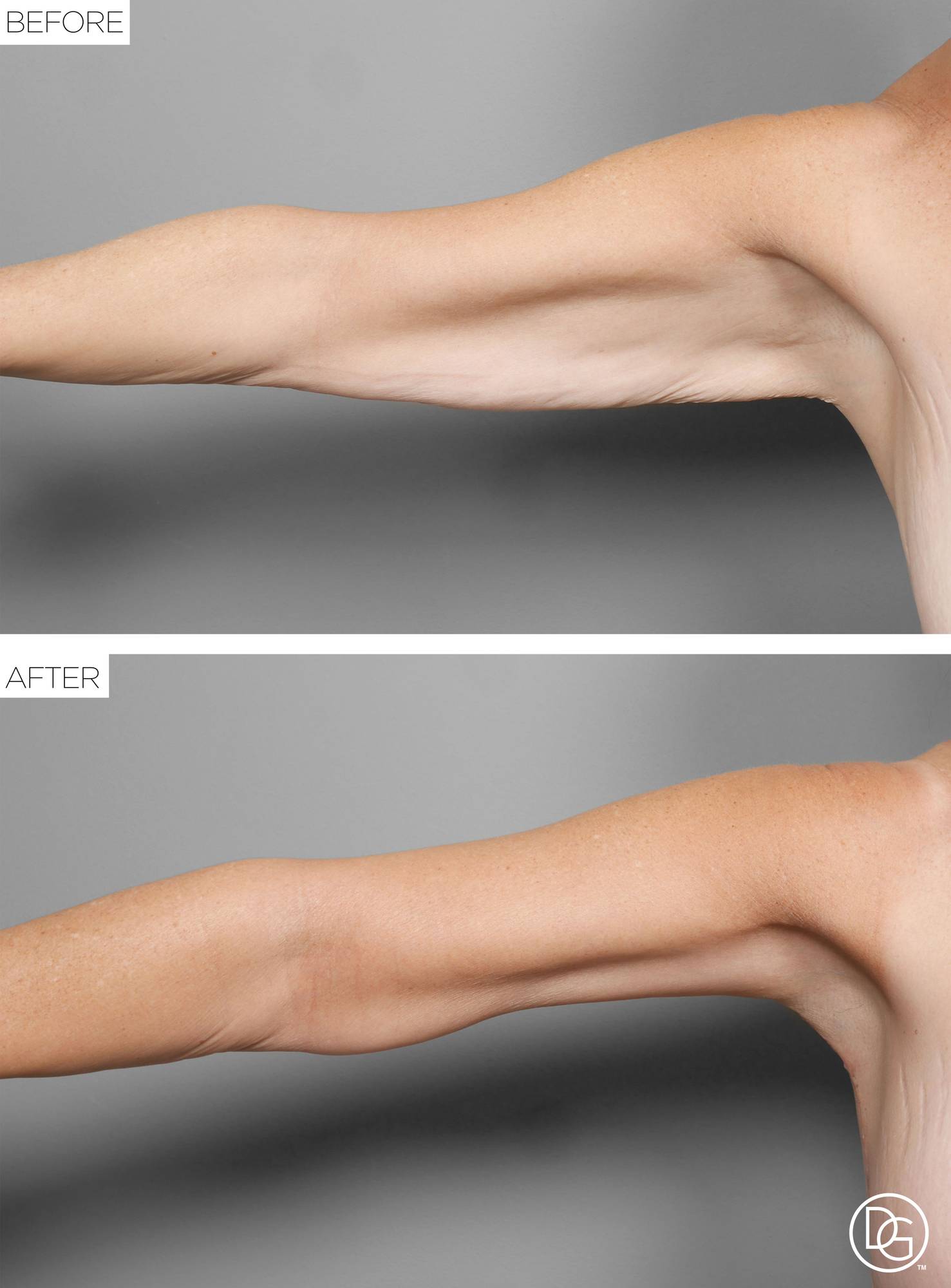 Before & After Image