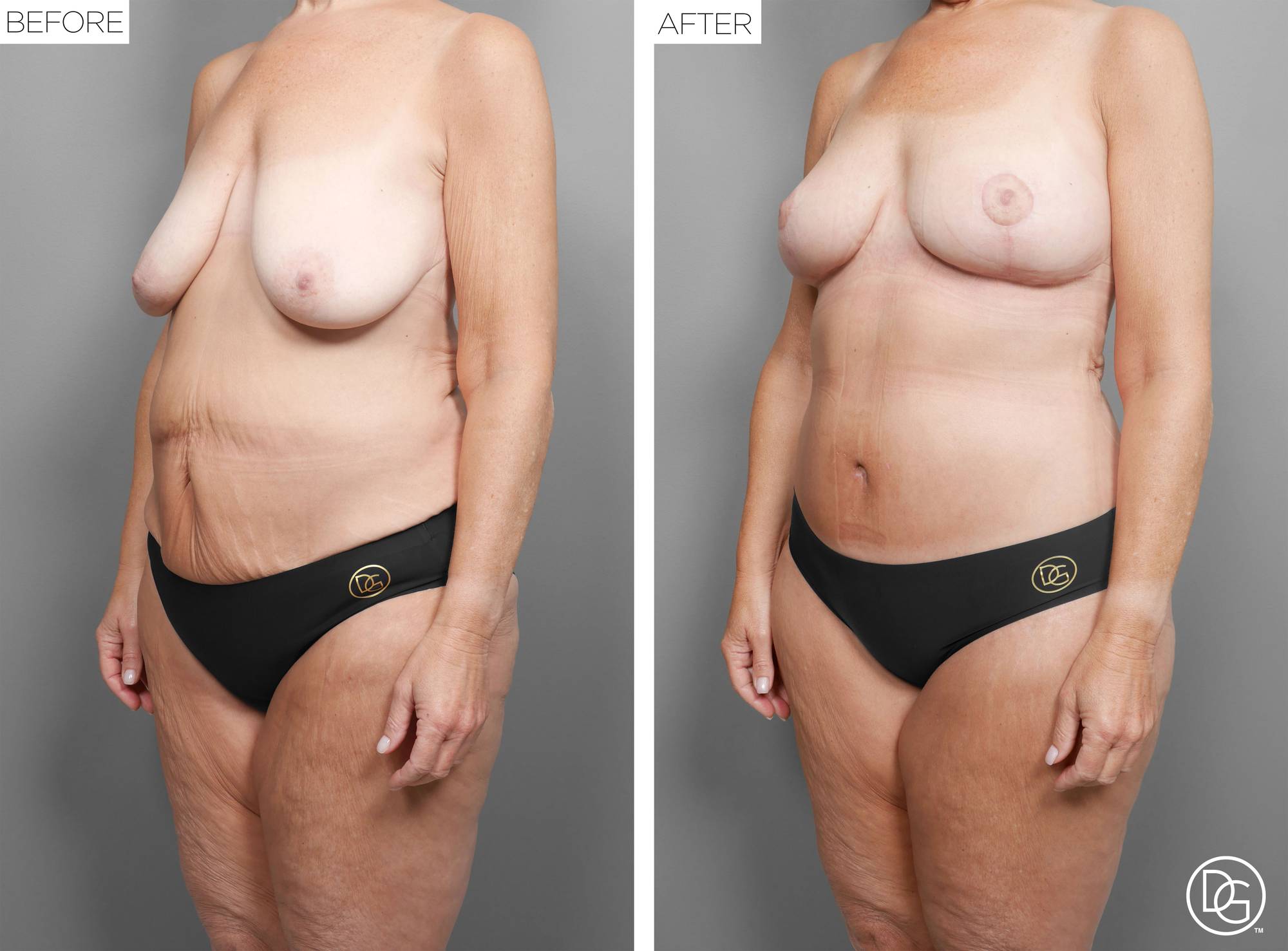 Before & After Image