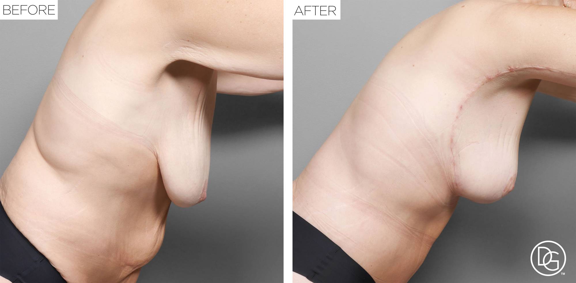 Before & After Image