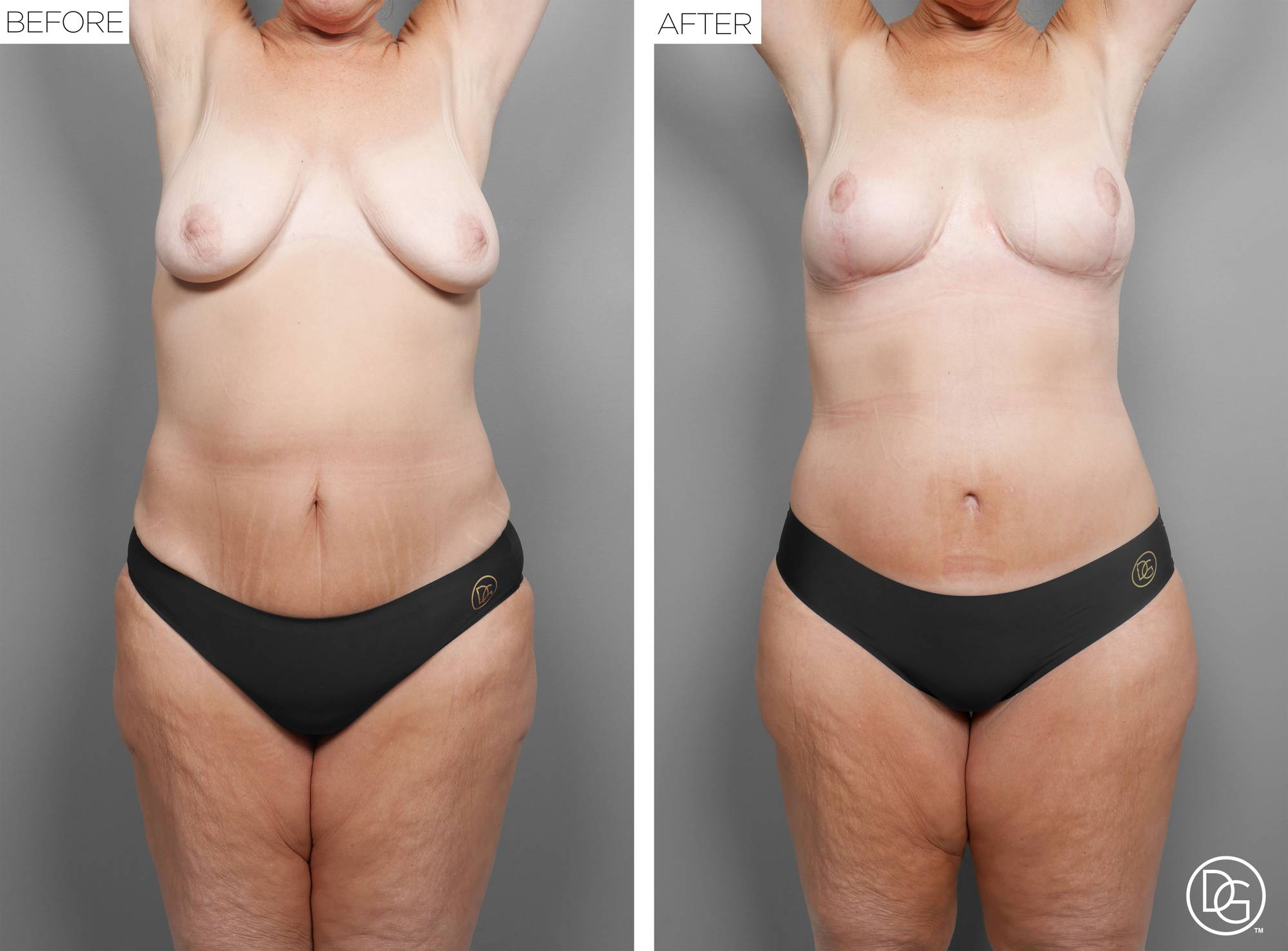 Before & After Image