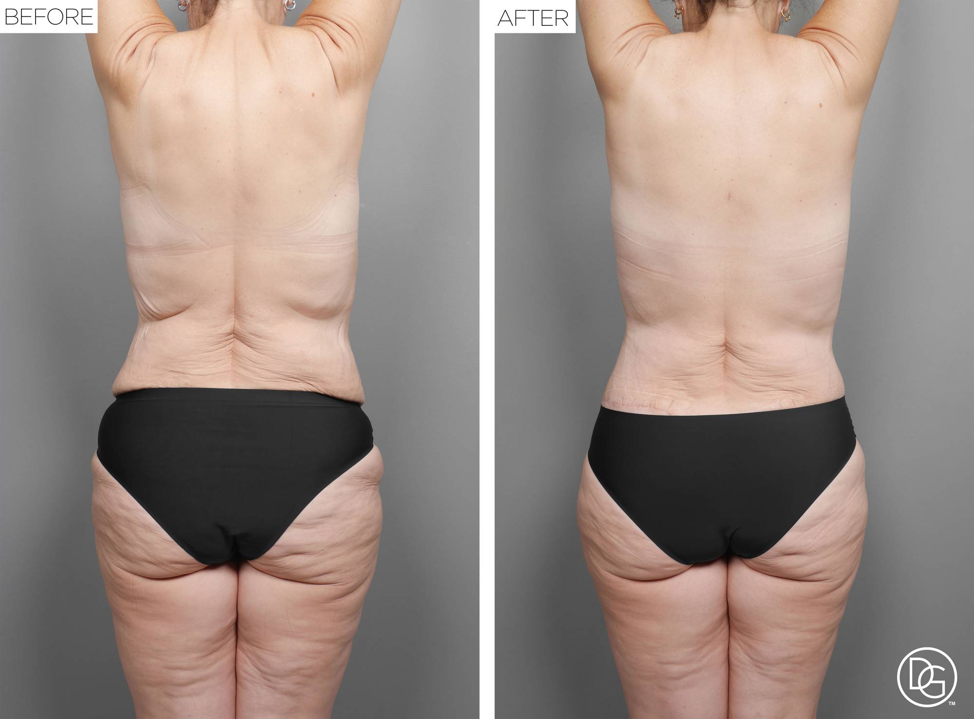 Before & After Image