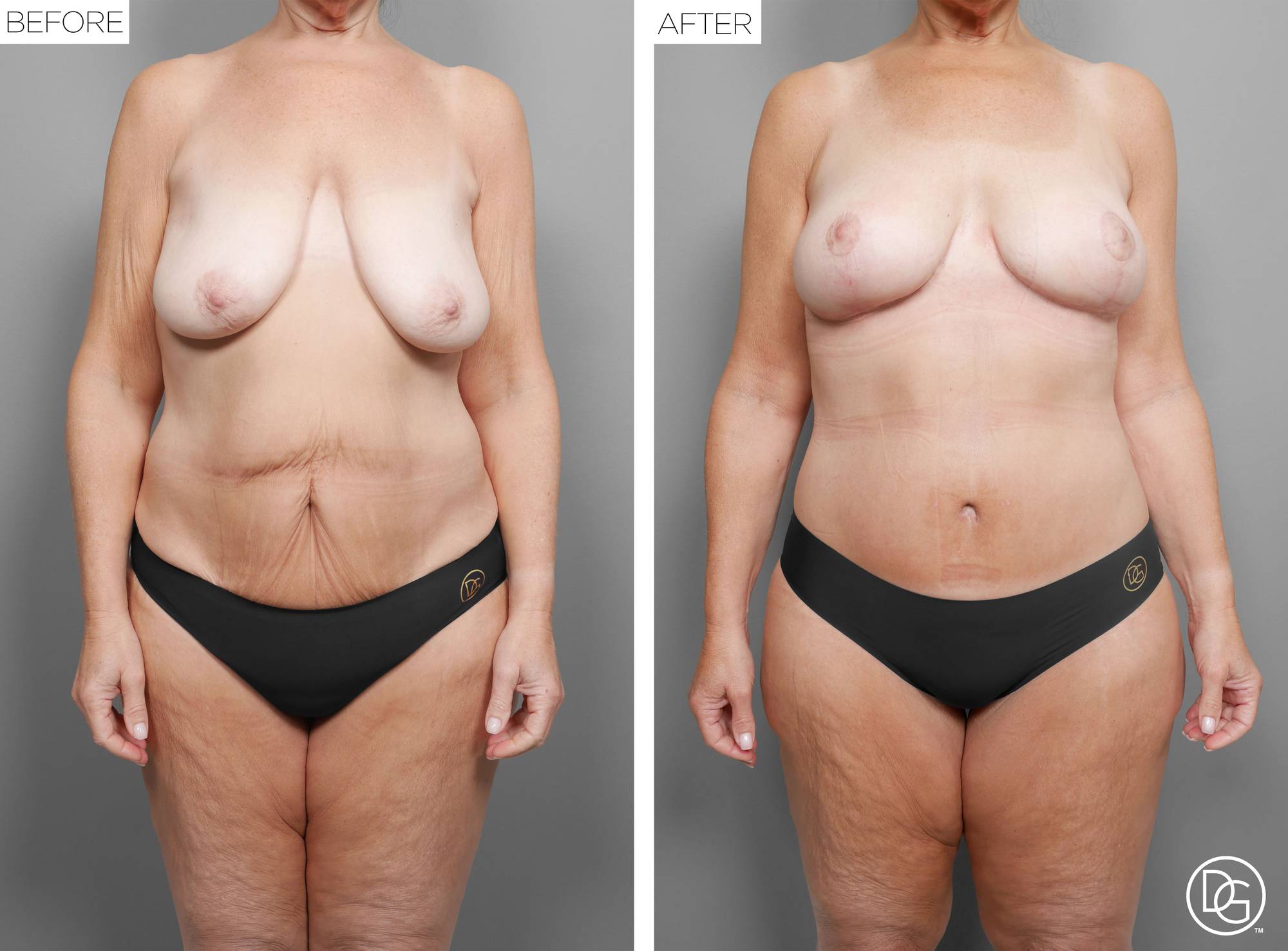 Before & After Image