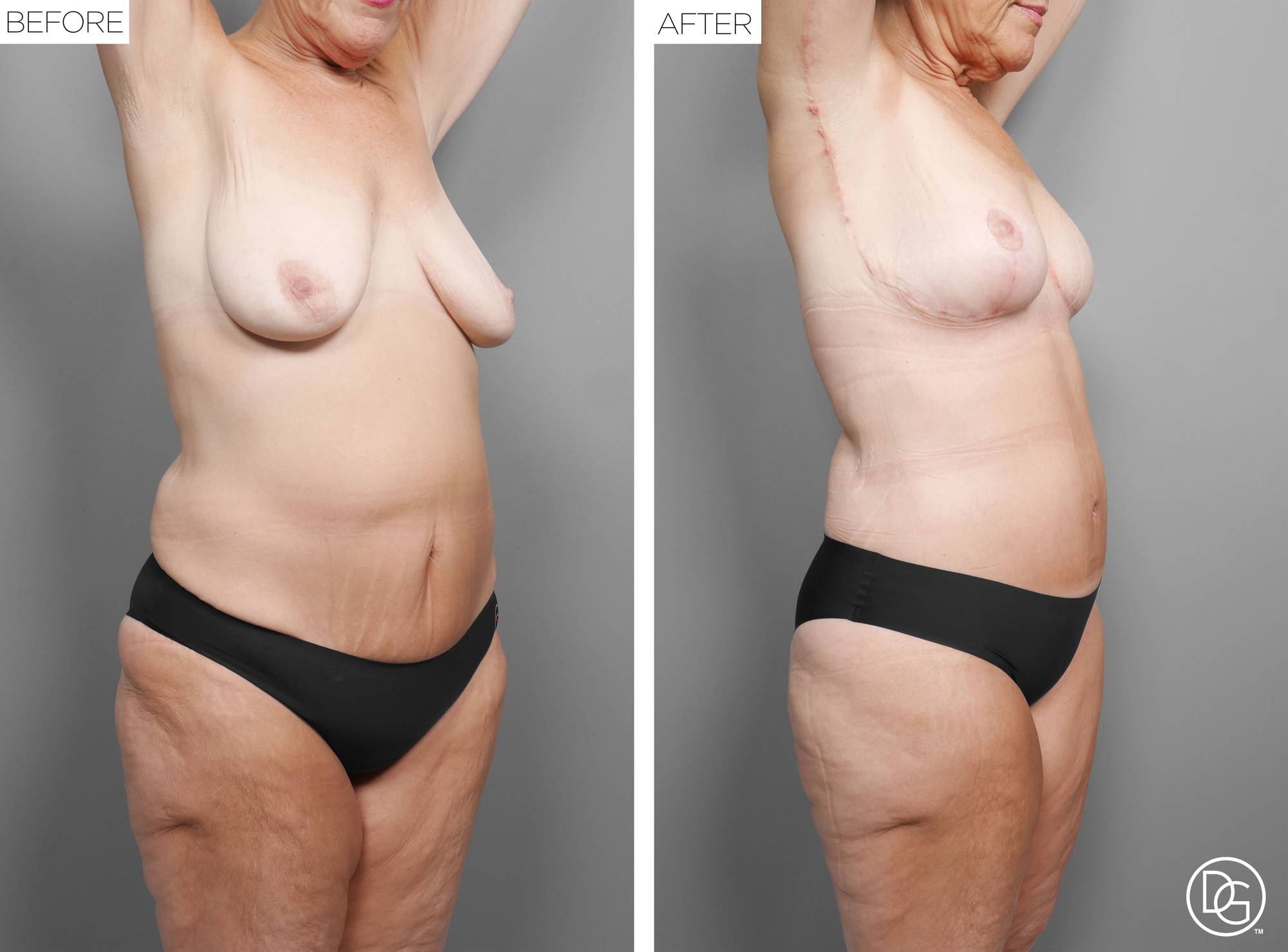 Before & After Image