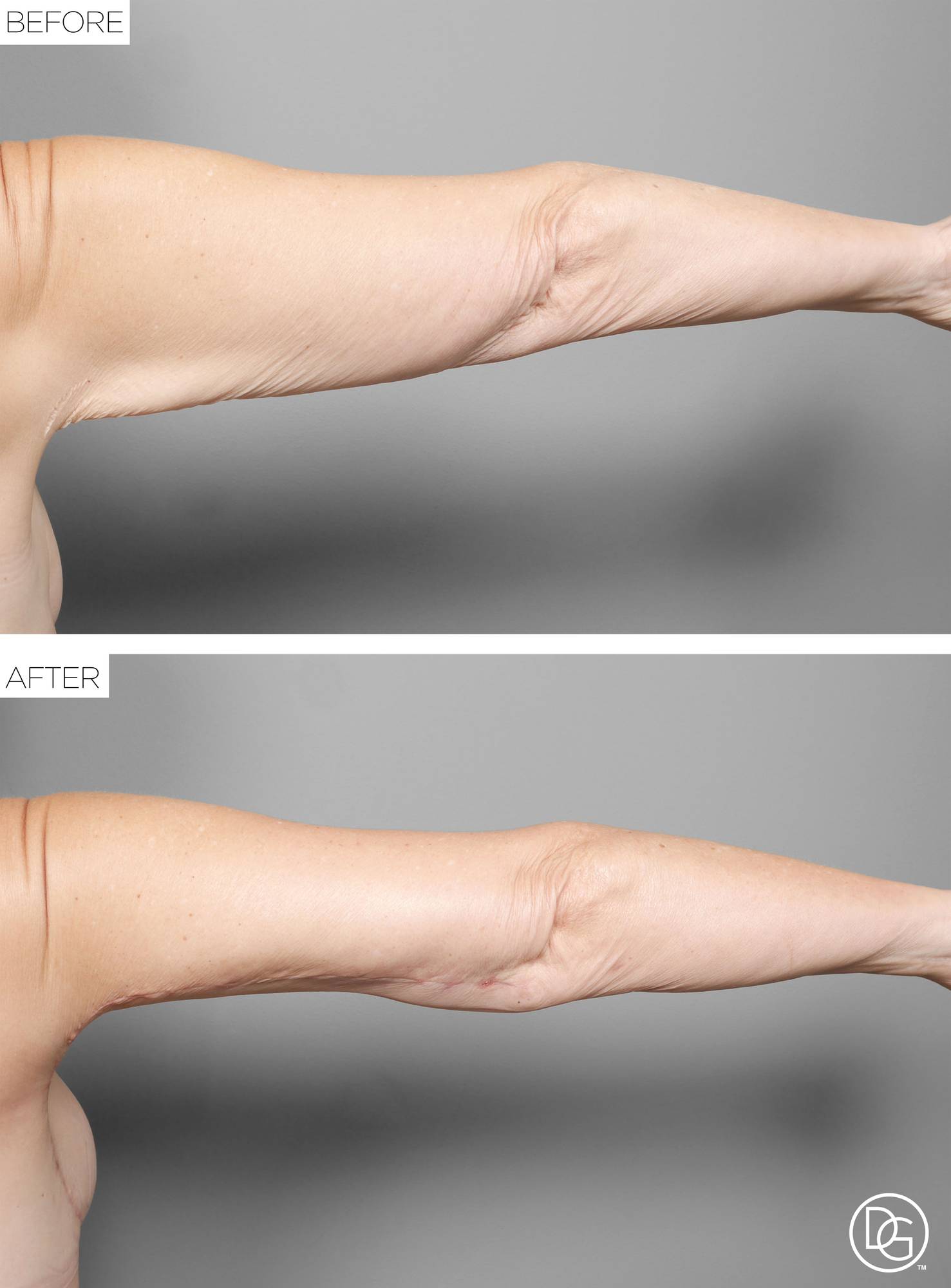 Before & After Image