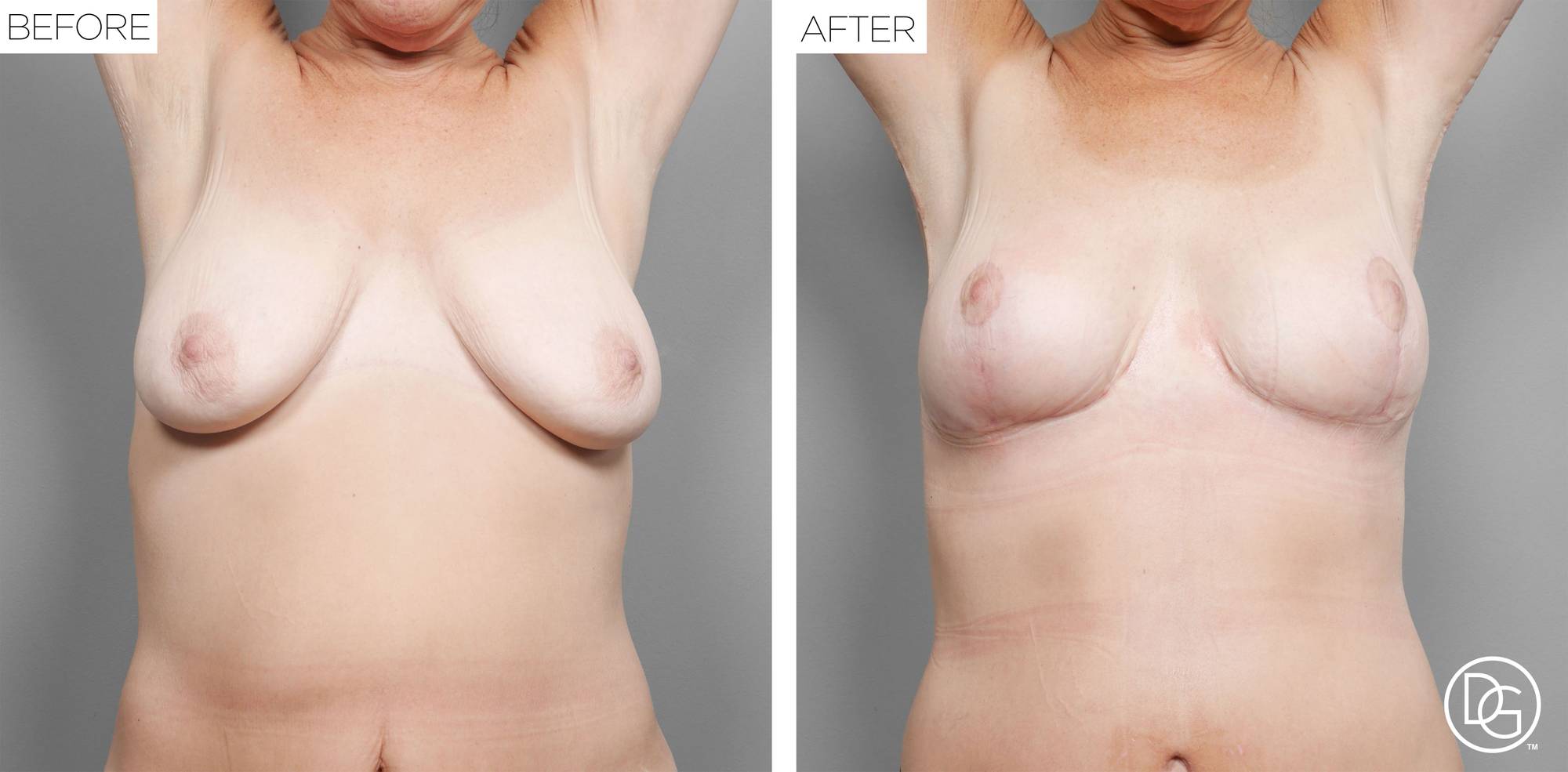 Before & After Image