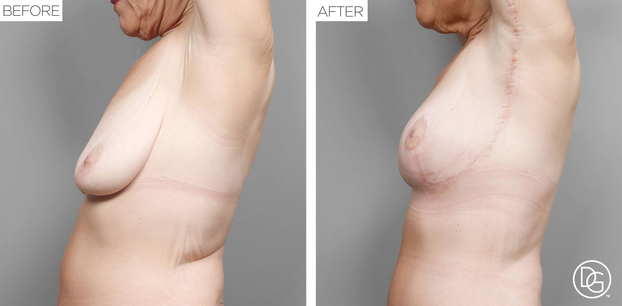 Before & After Image