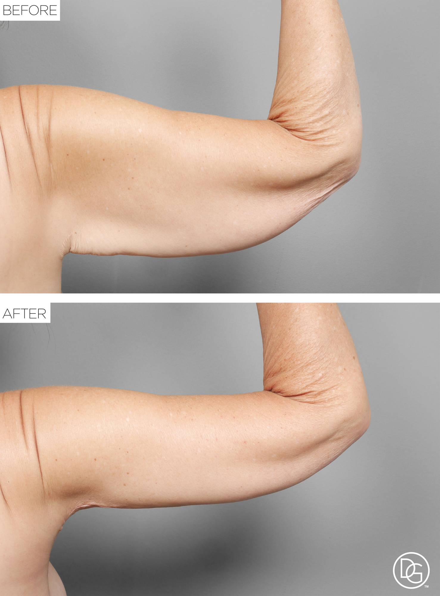 Before & After Image