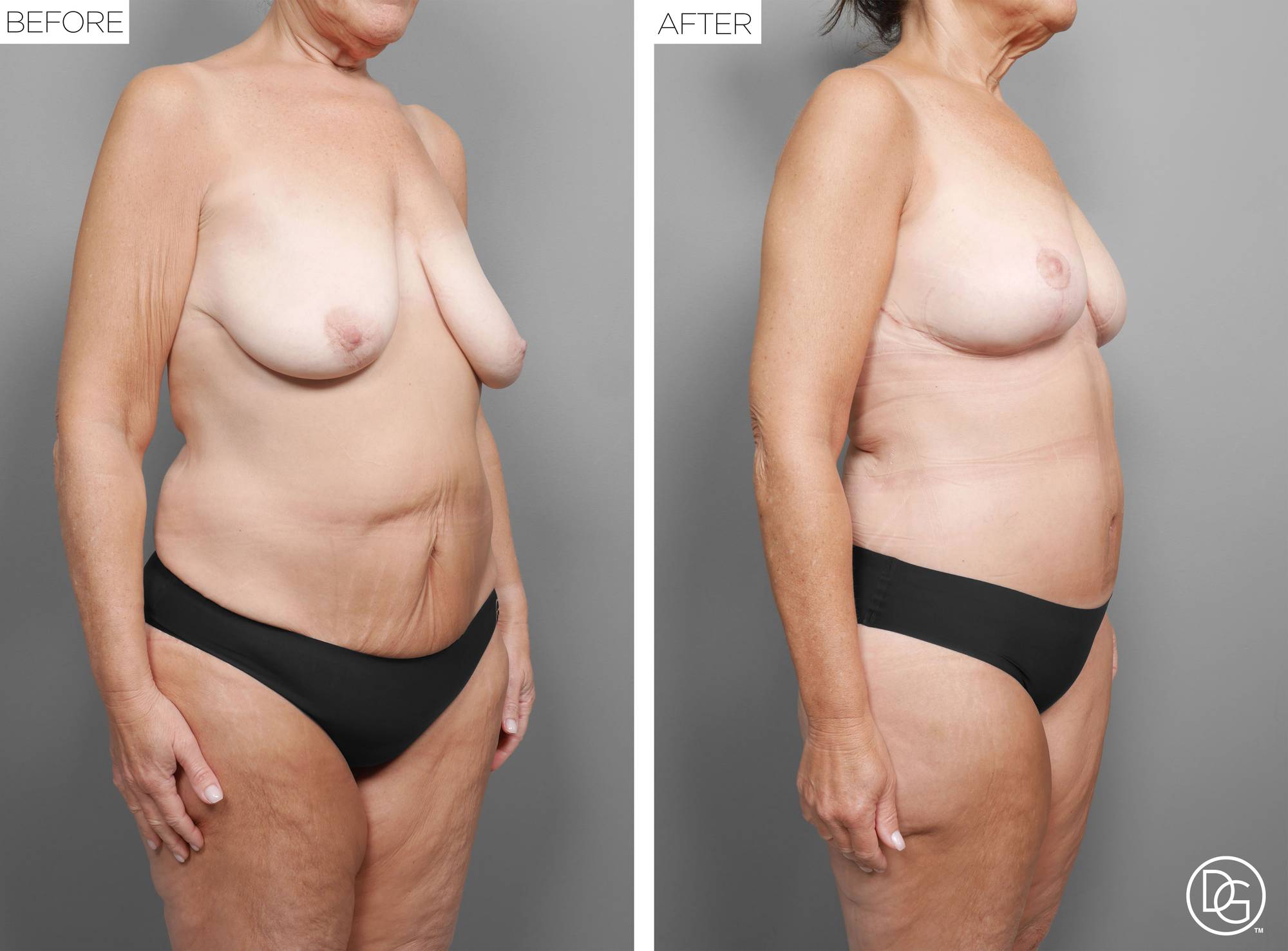 Before & After Image