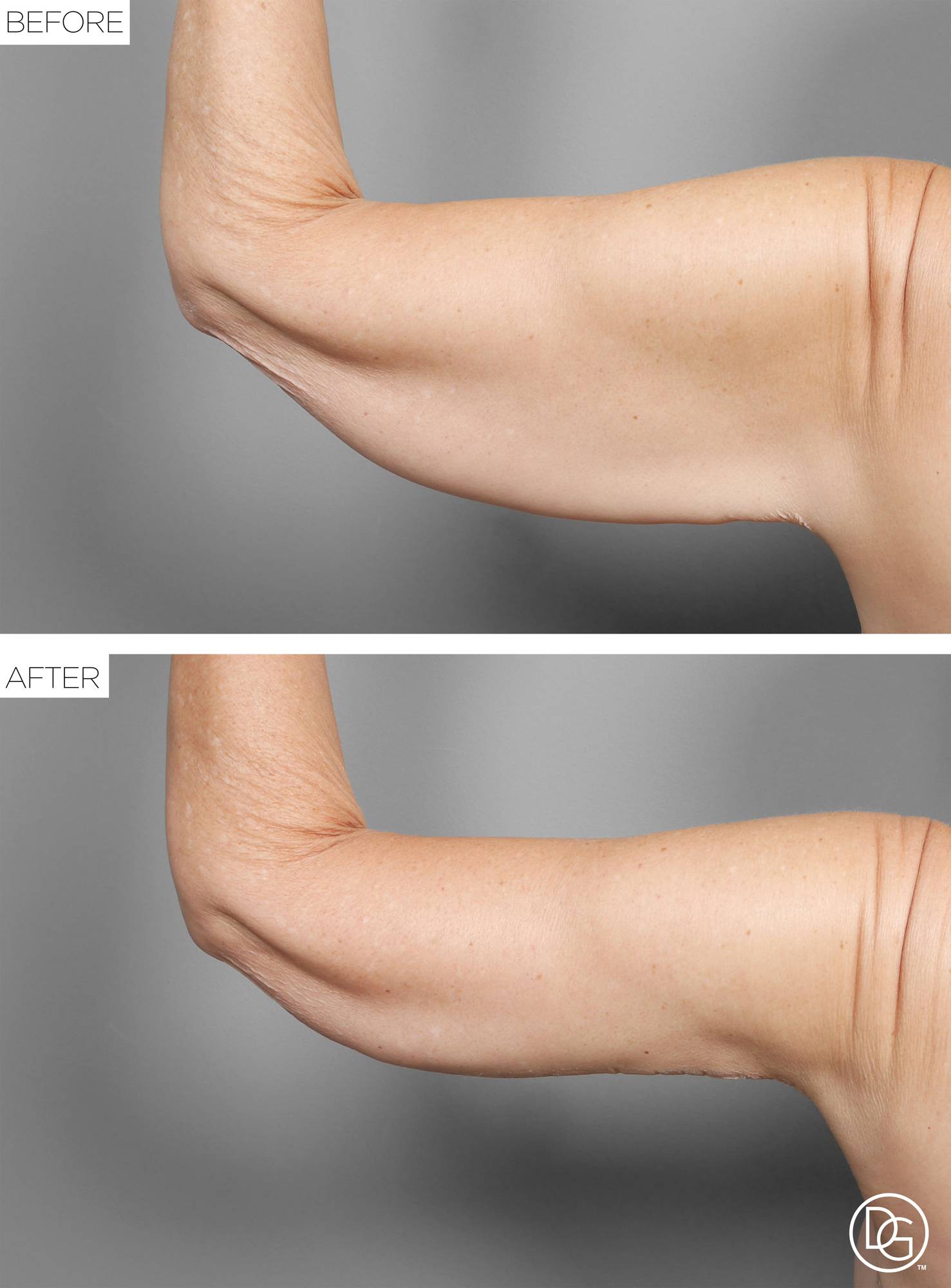 Before & After Image