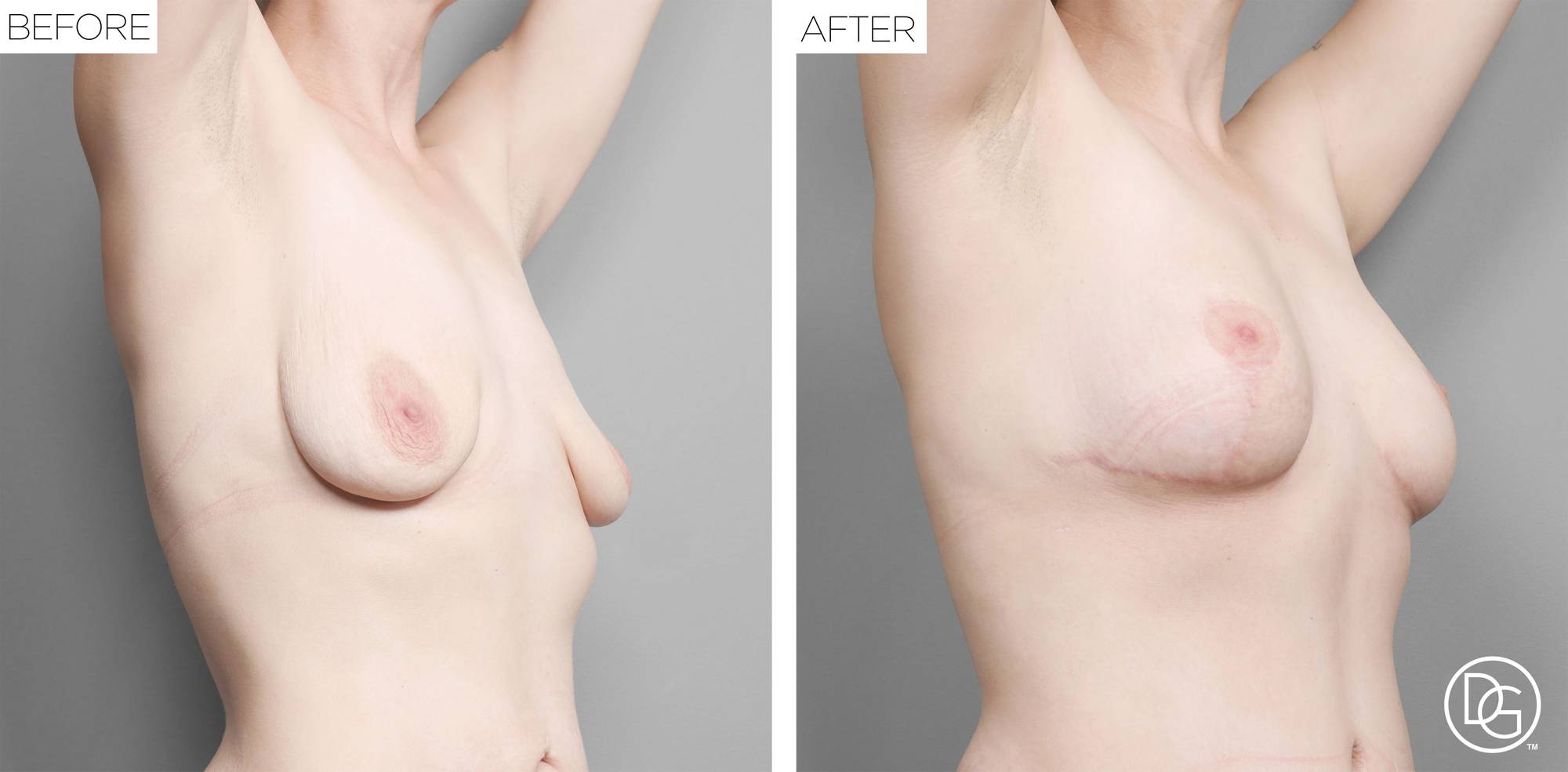 Before & After Image