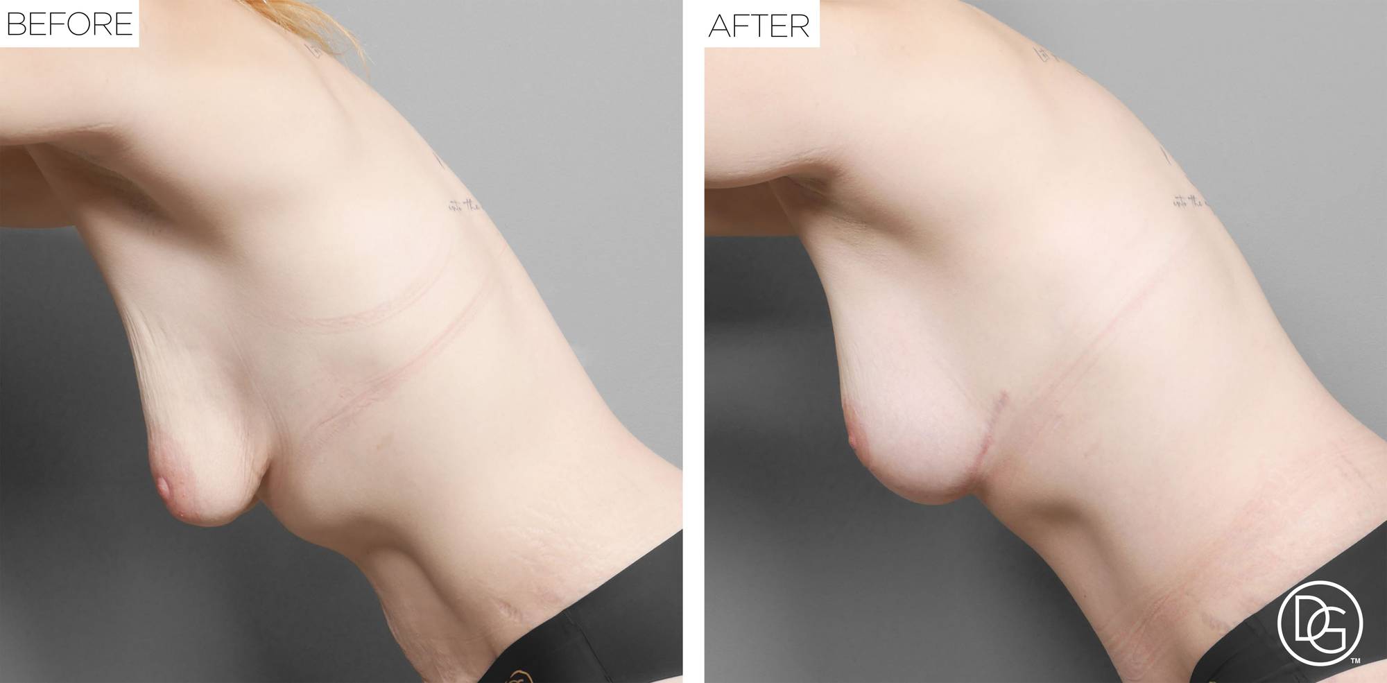 Before & After Image