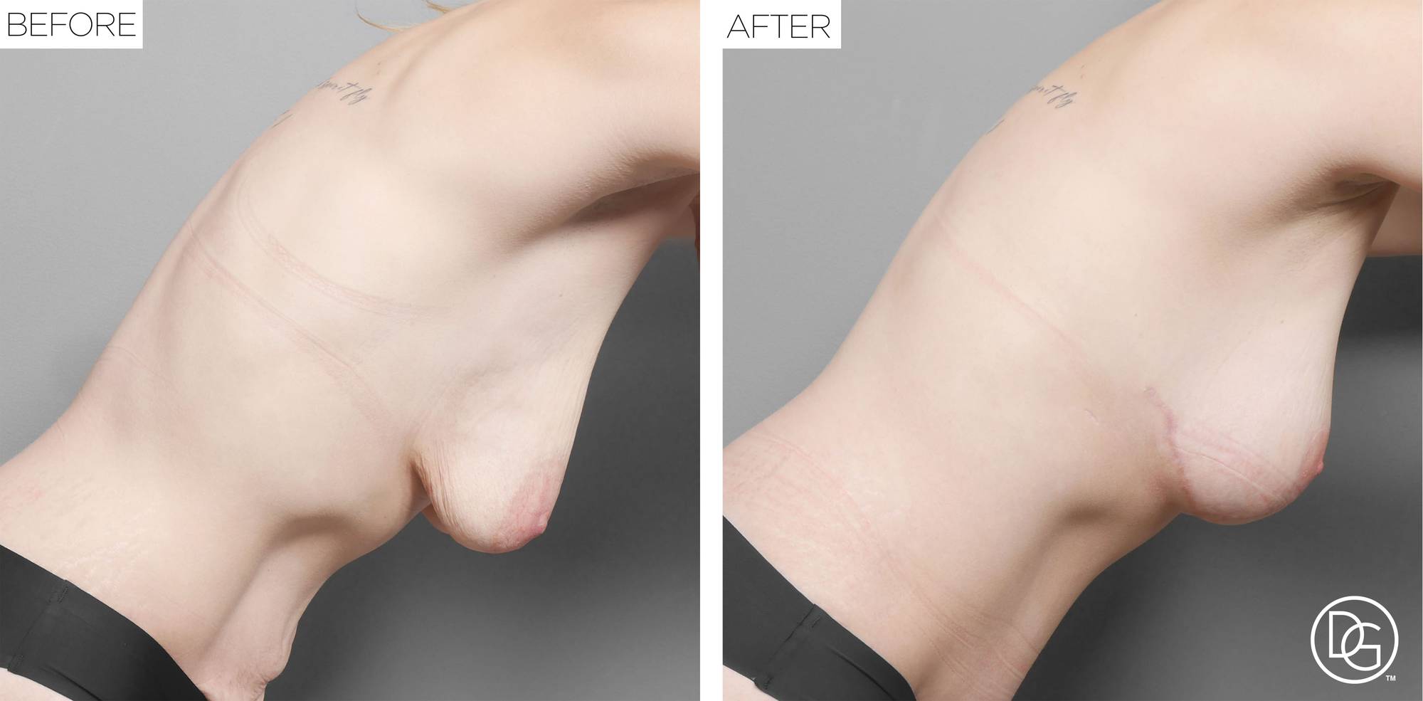 Before & After Image