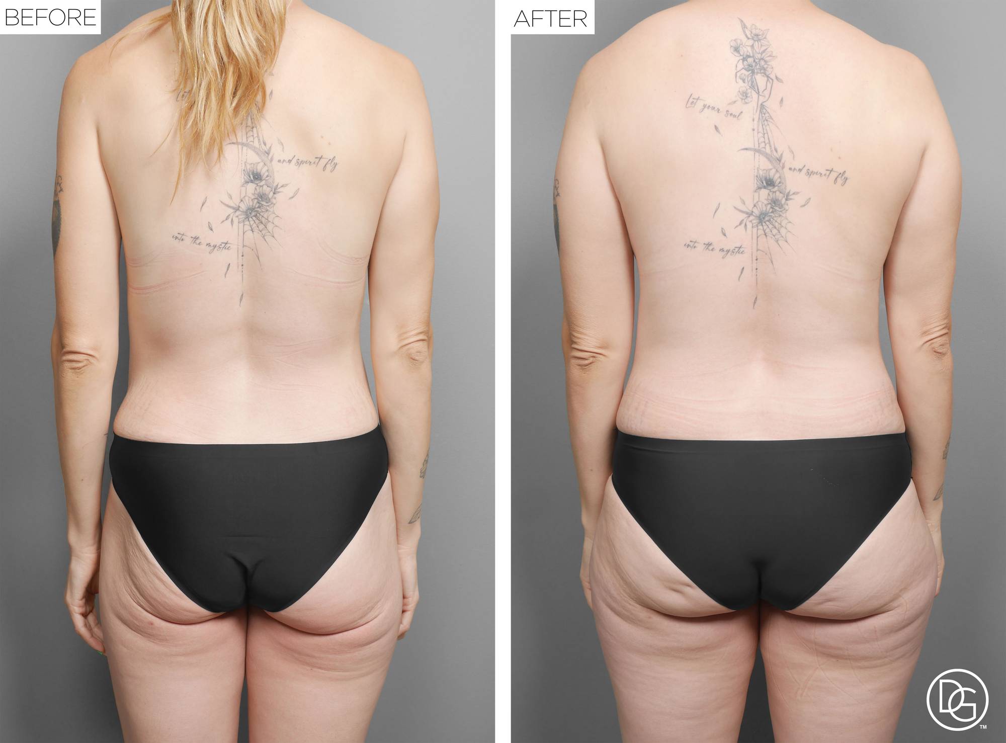 Before & After Image