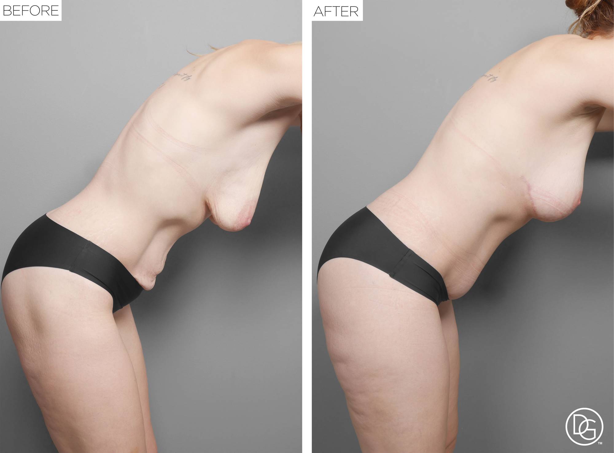 Before & After Image