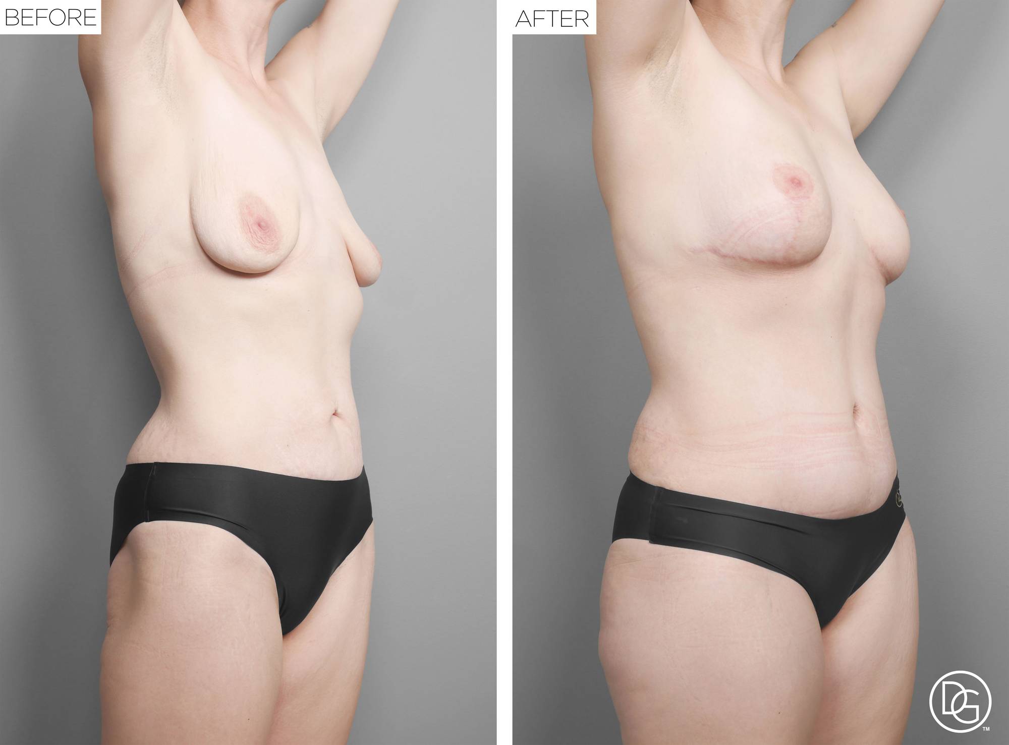 Before & After Image