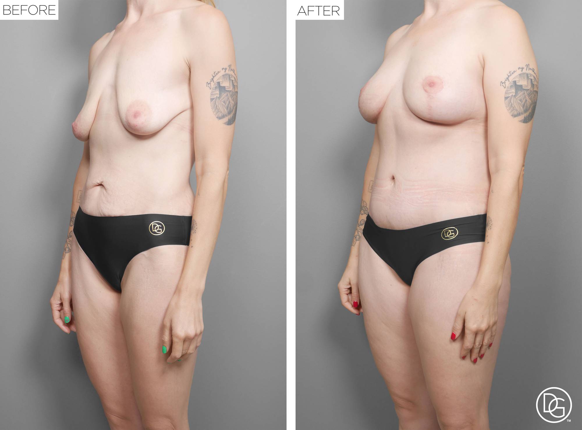 Before & After Image