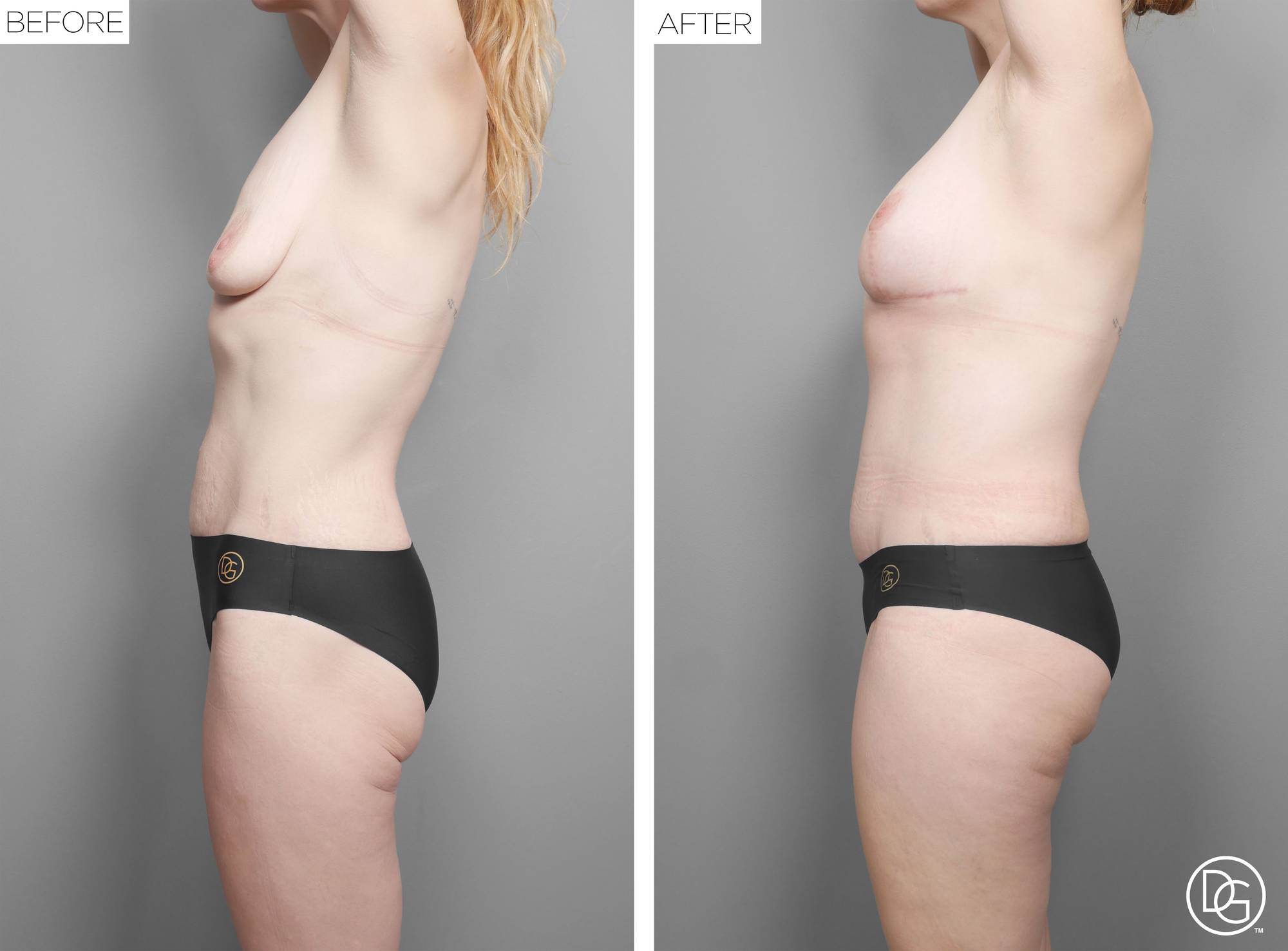 Before & After Image