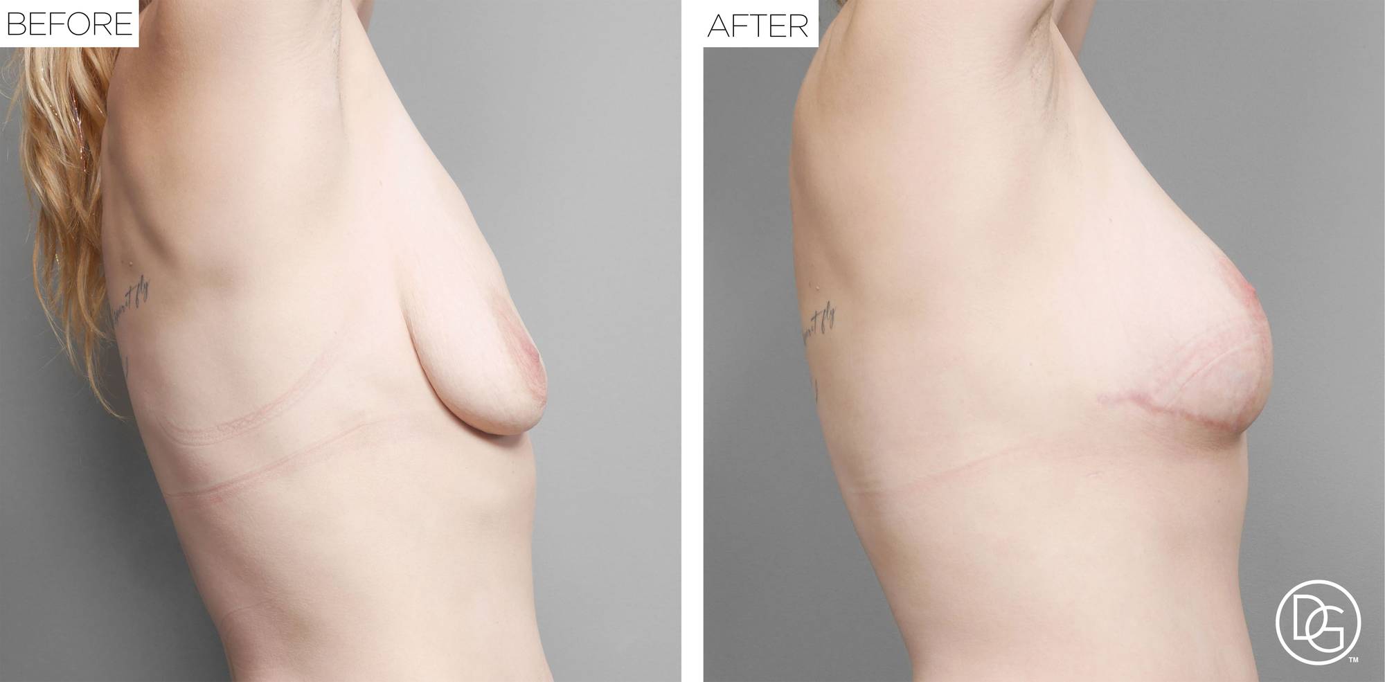 Before & After Image