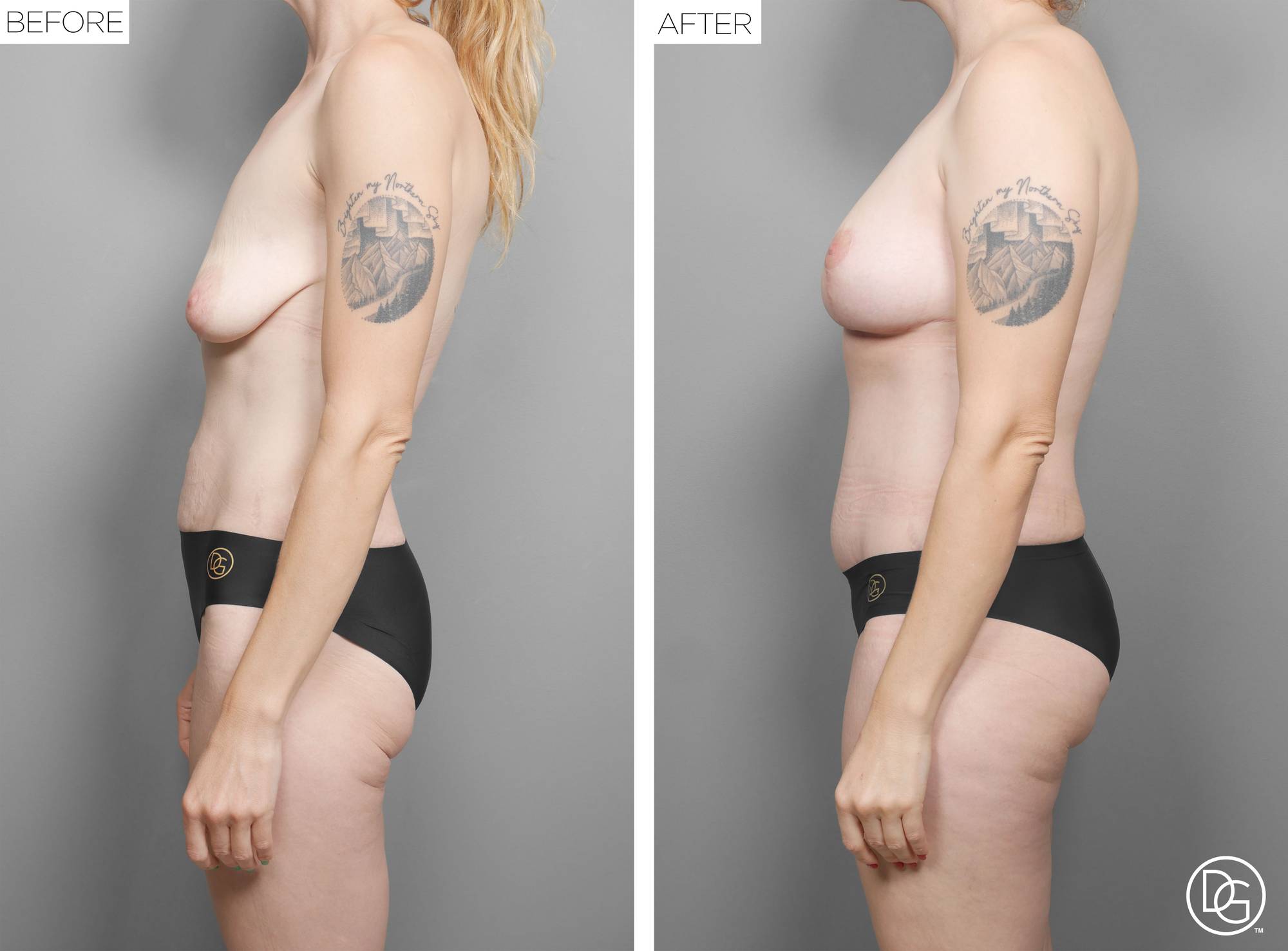 Before & After Image