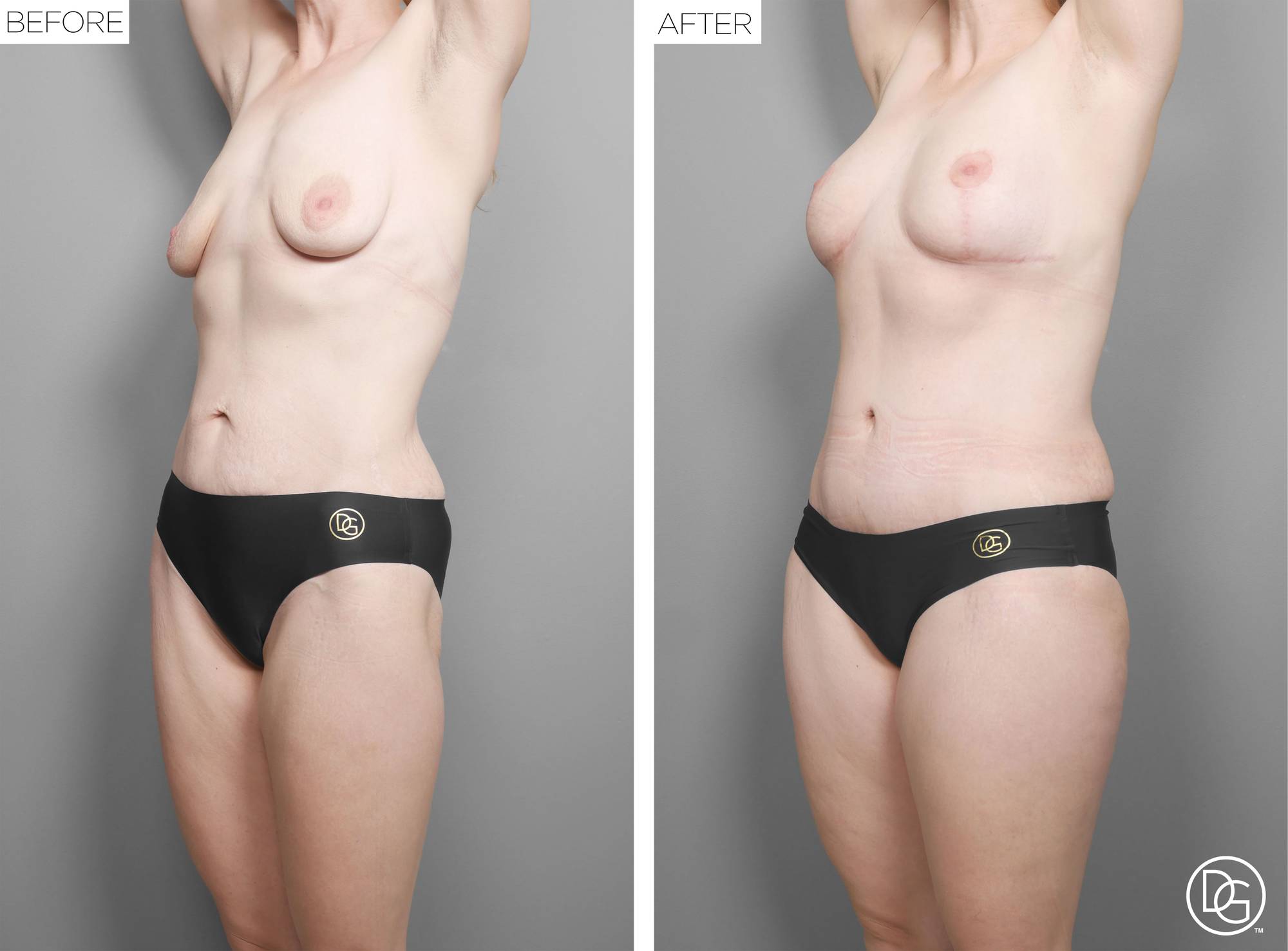 Before & After Image