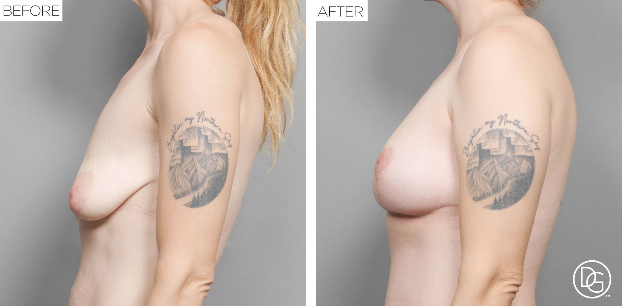 Before & After Image