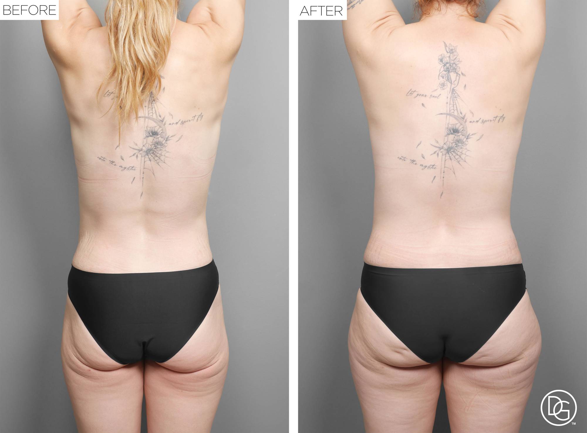 Before & After Image