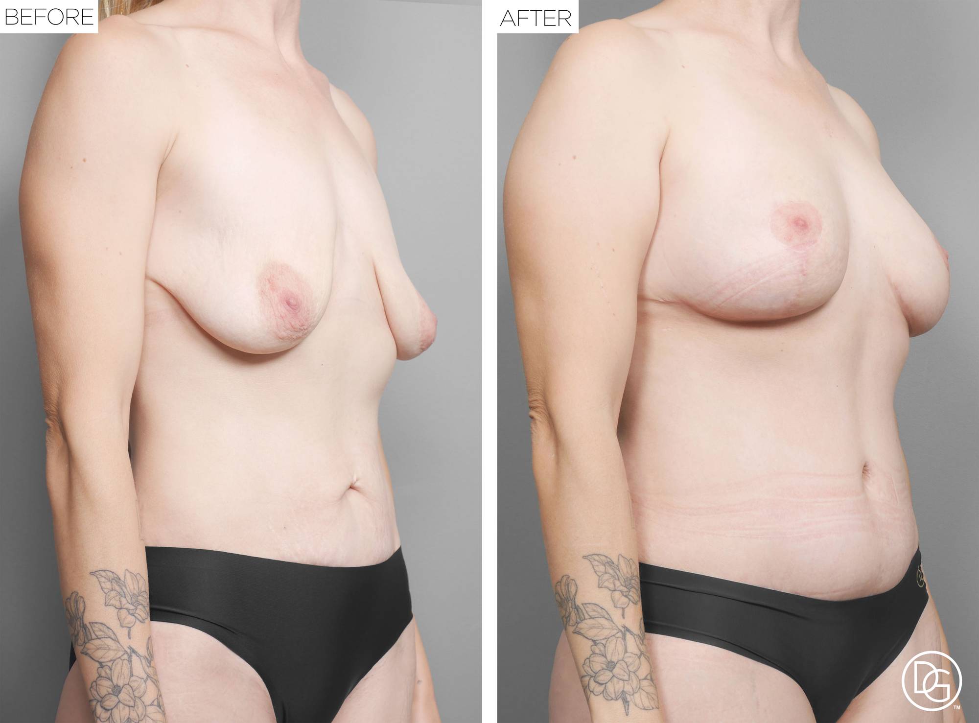 Before & After Image