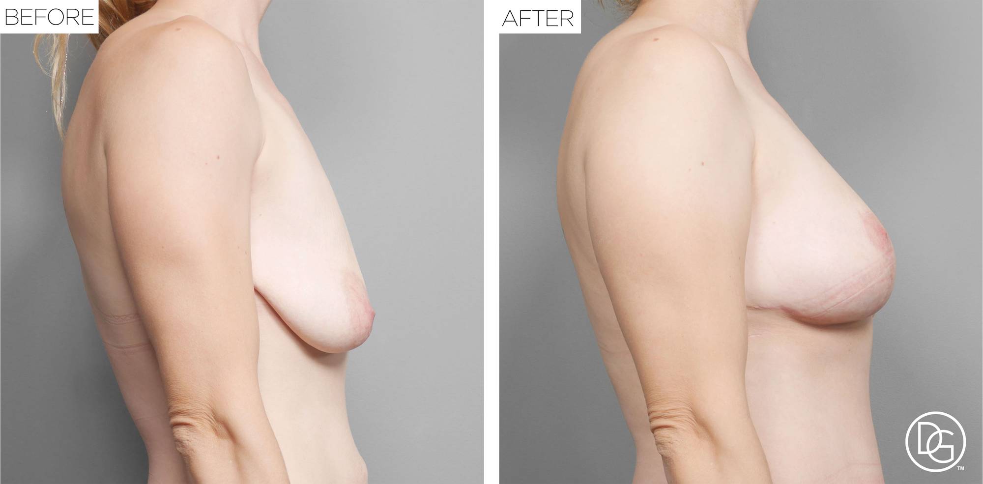 Before & After Image