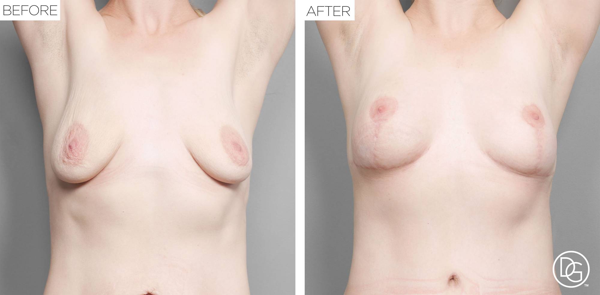 Before & After Image