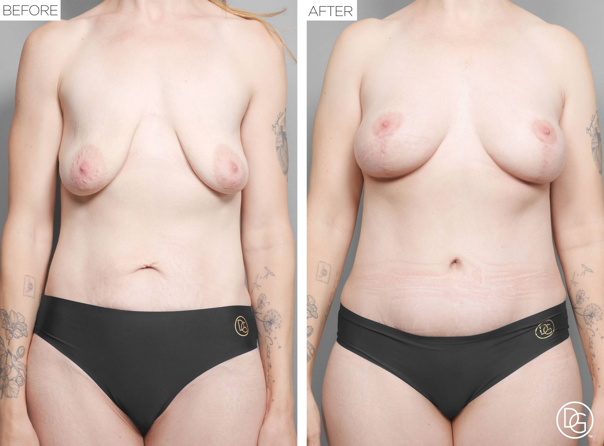 Before & After Image