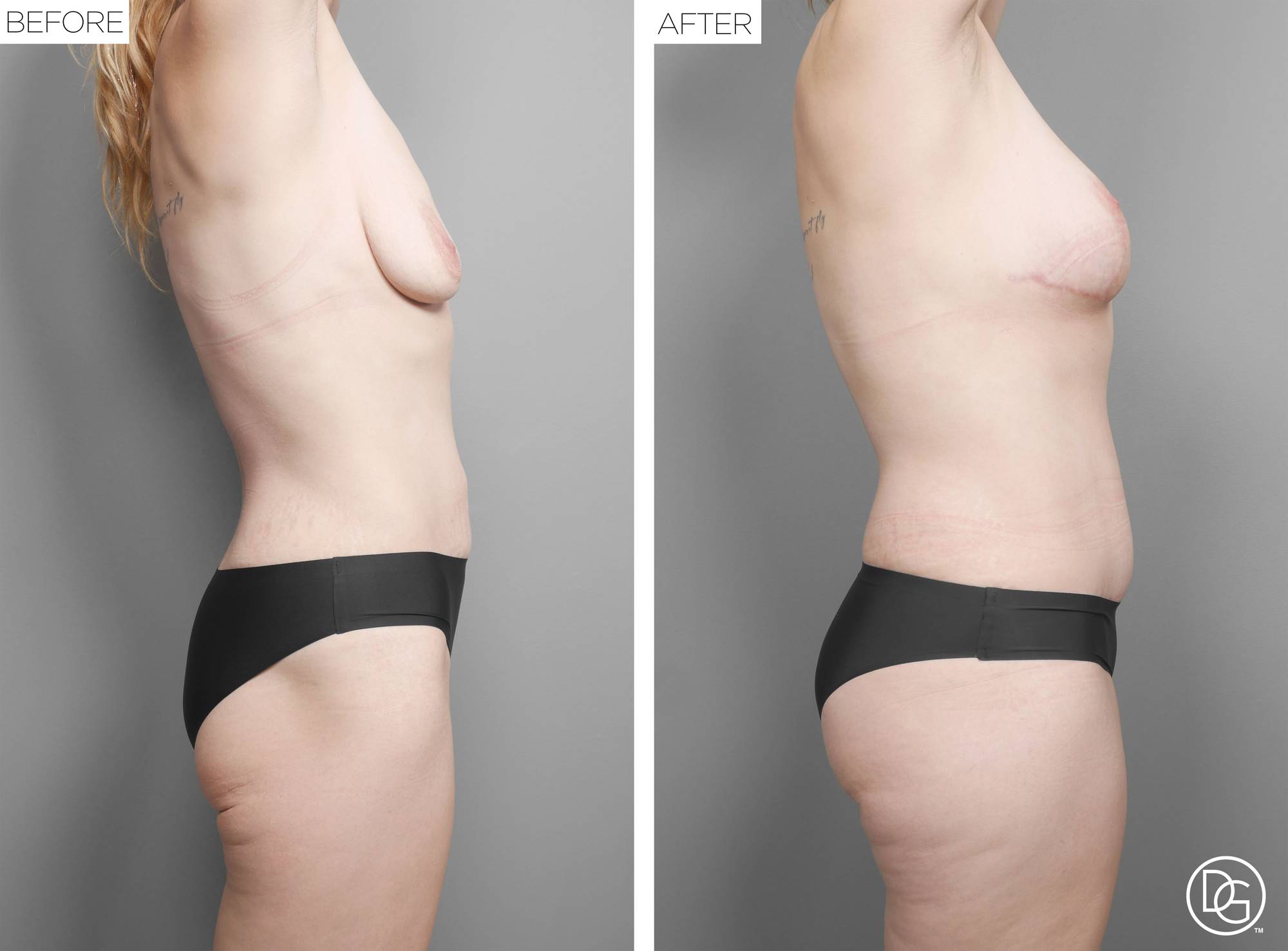 Before & After Image