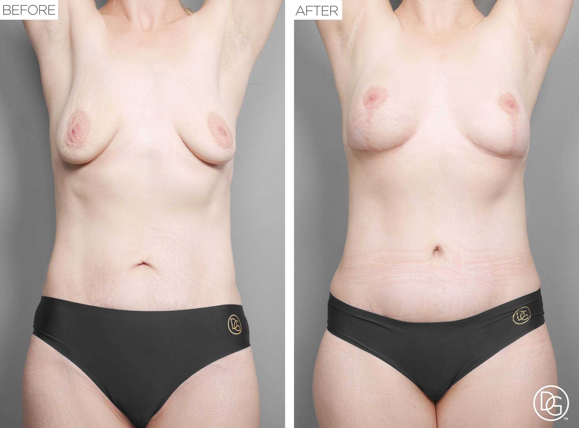 Before & After Image