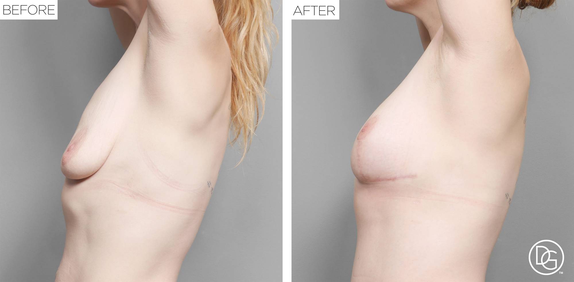 Before & After Image