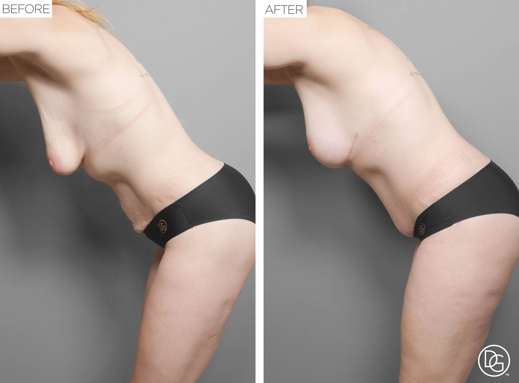 Before & After Image