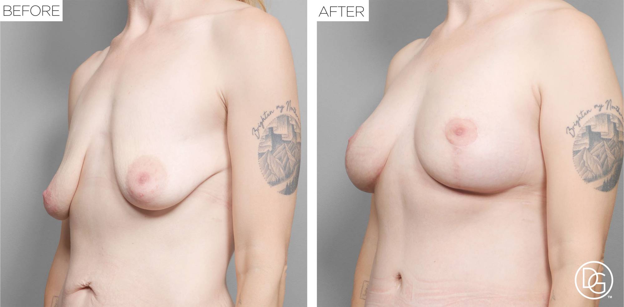 Before & After Image