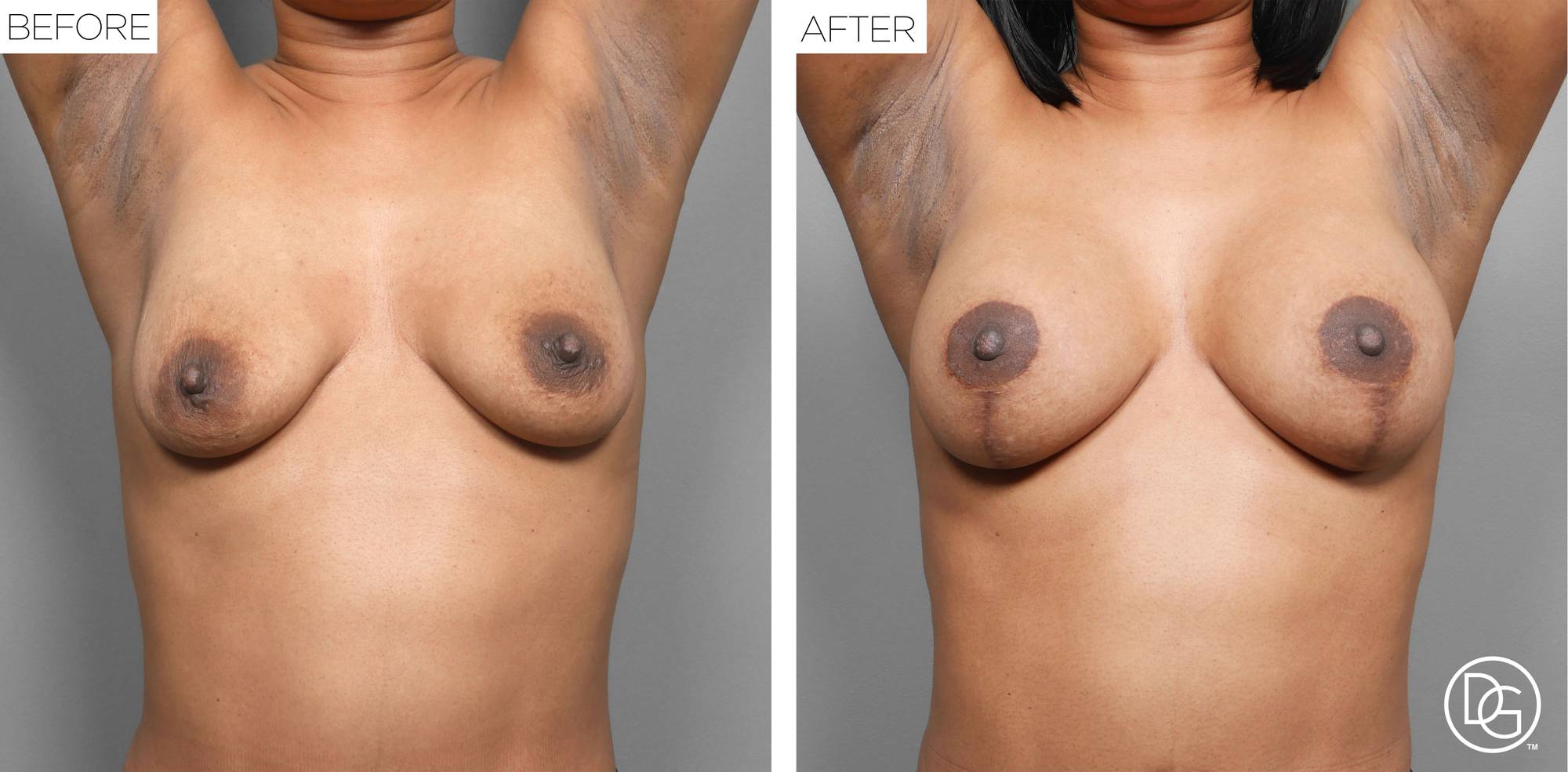 Before & After Image