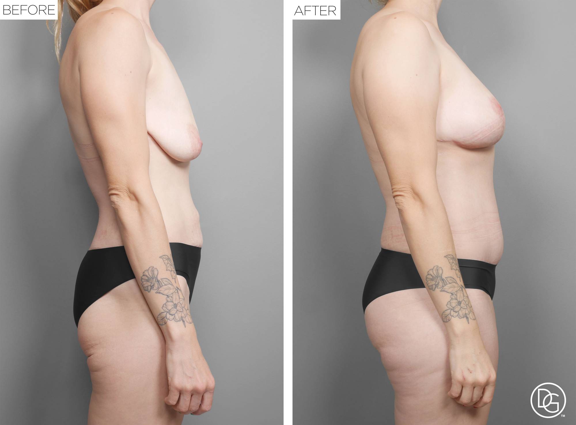 Before & After Image