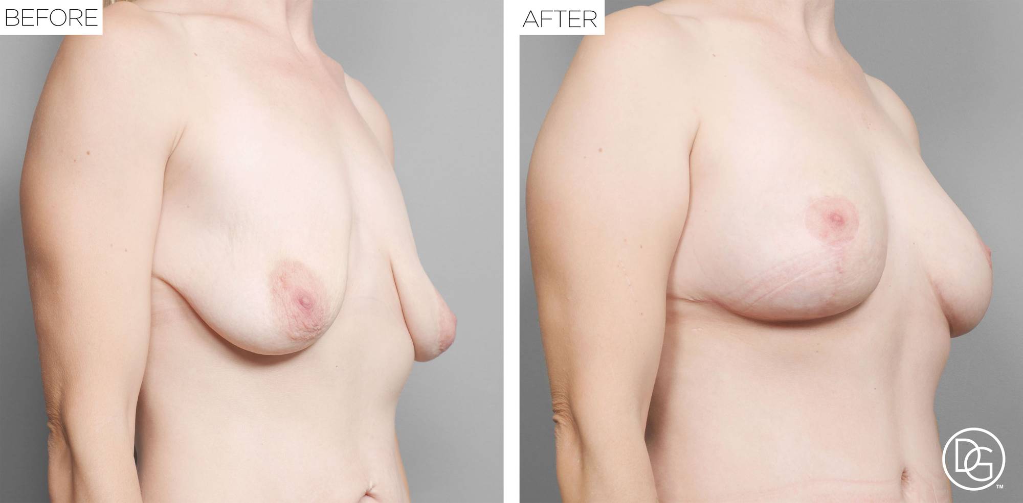 Before & After Image