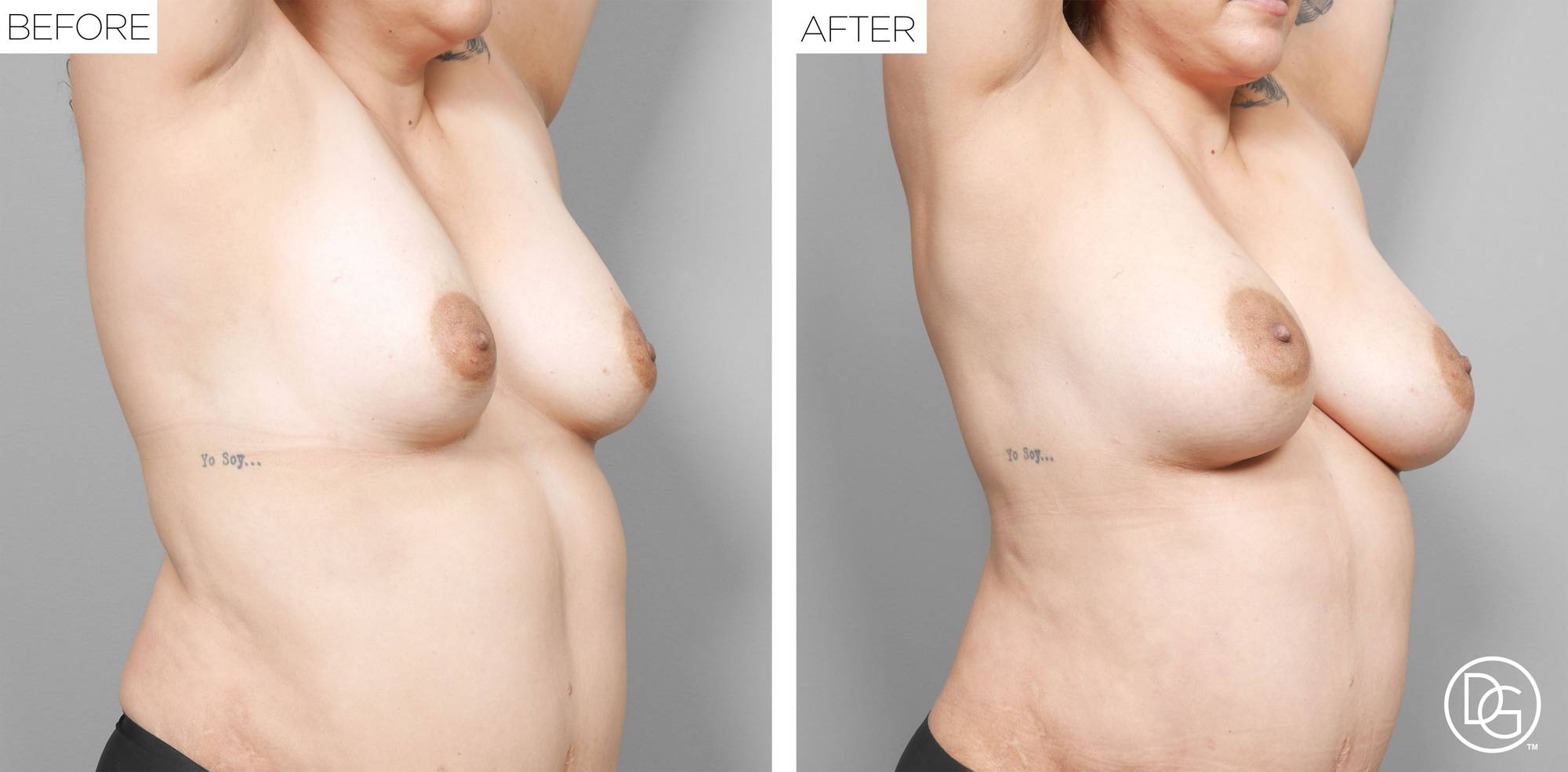 Before & After Image