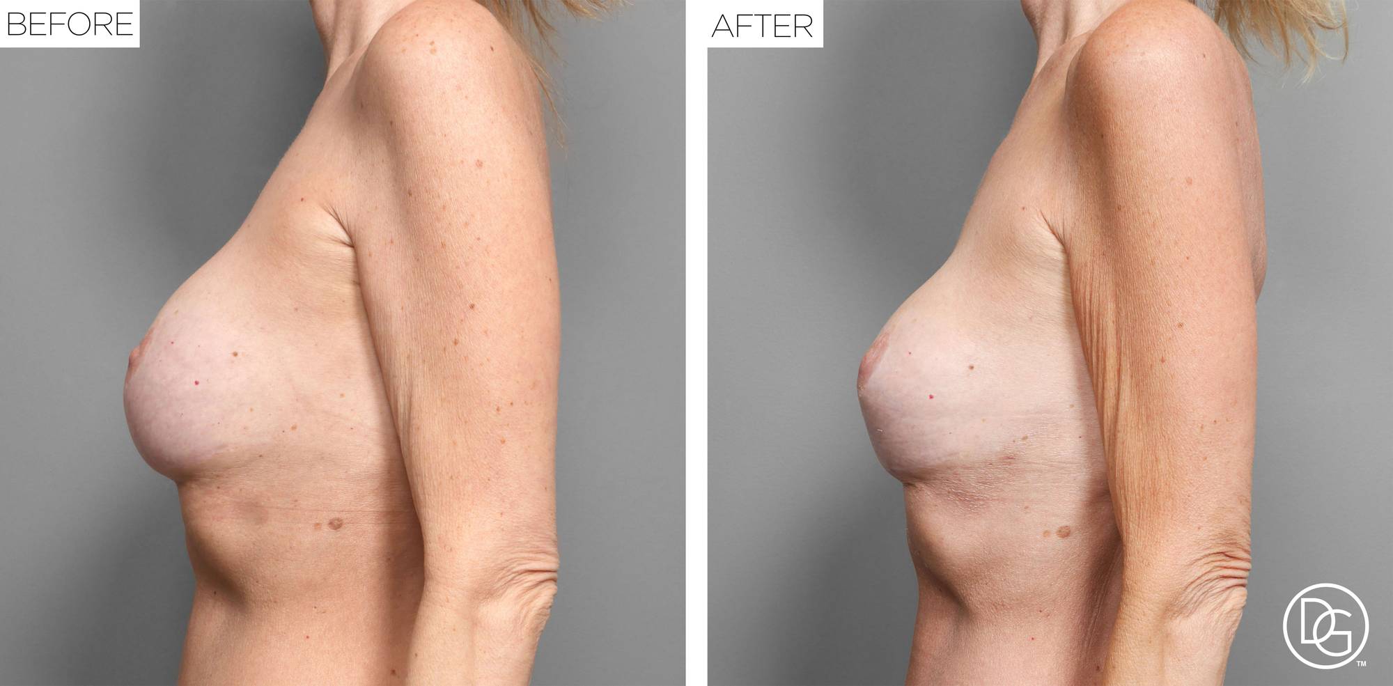 Before & After Image