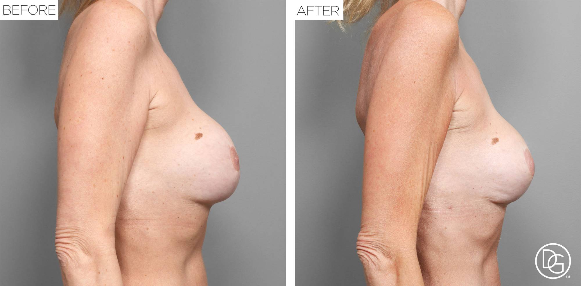 Before & After Image