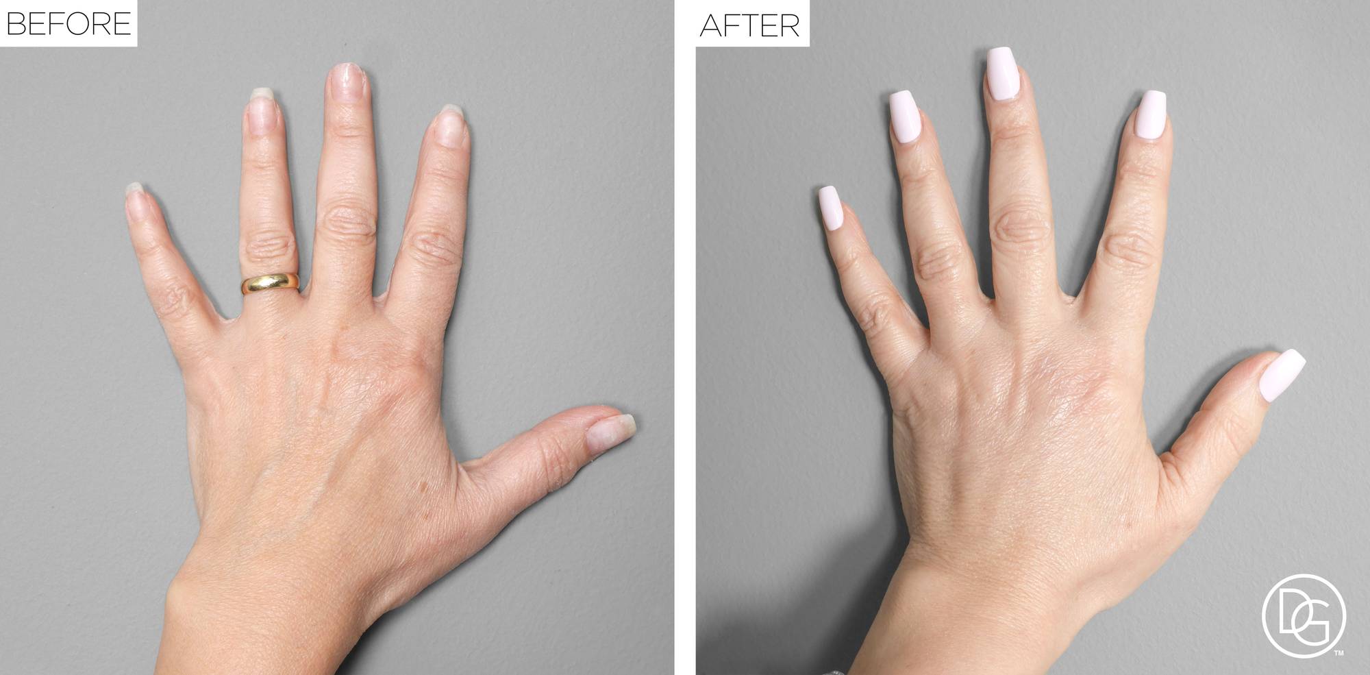 Before & After Image