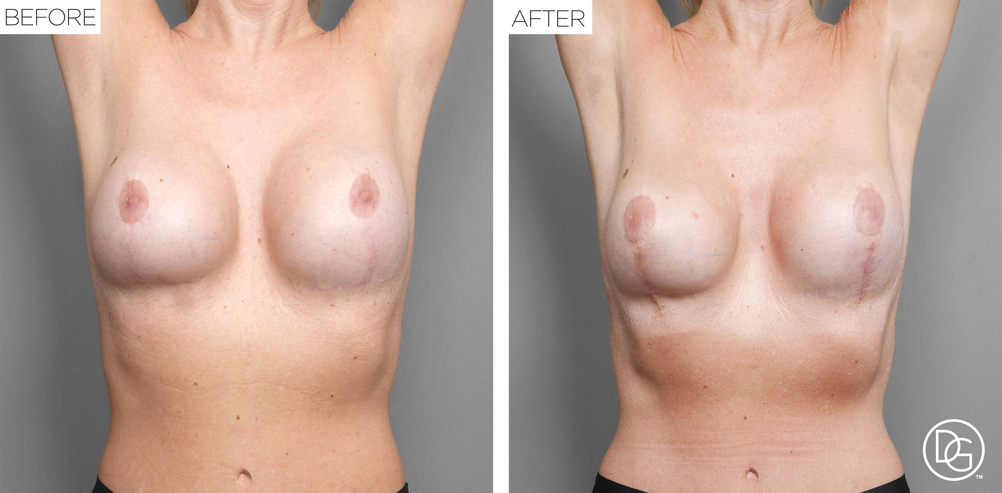 Before & After Image